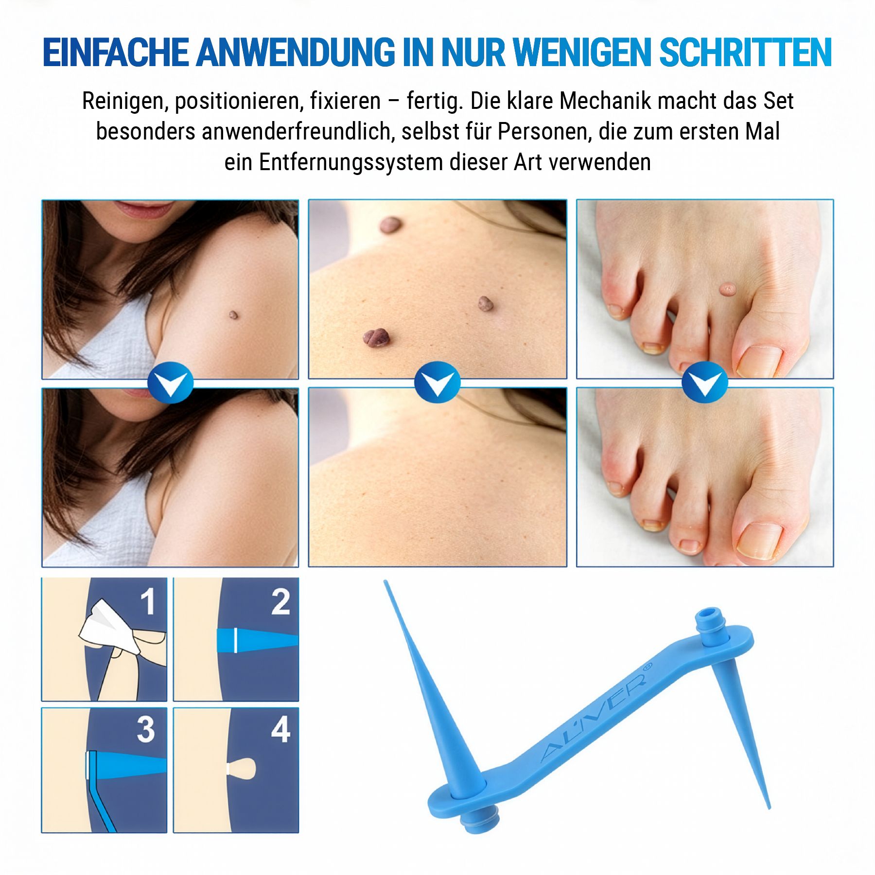 Illustrazioni delle fasi di utilizzo. Applicatore e aree cutanee. Testo: FACILE APPLICAZIONE IN POCHI PASSAGGI.
