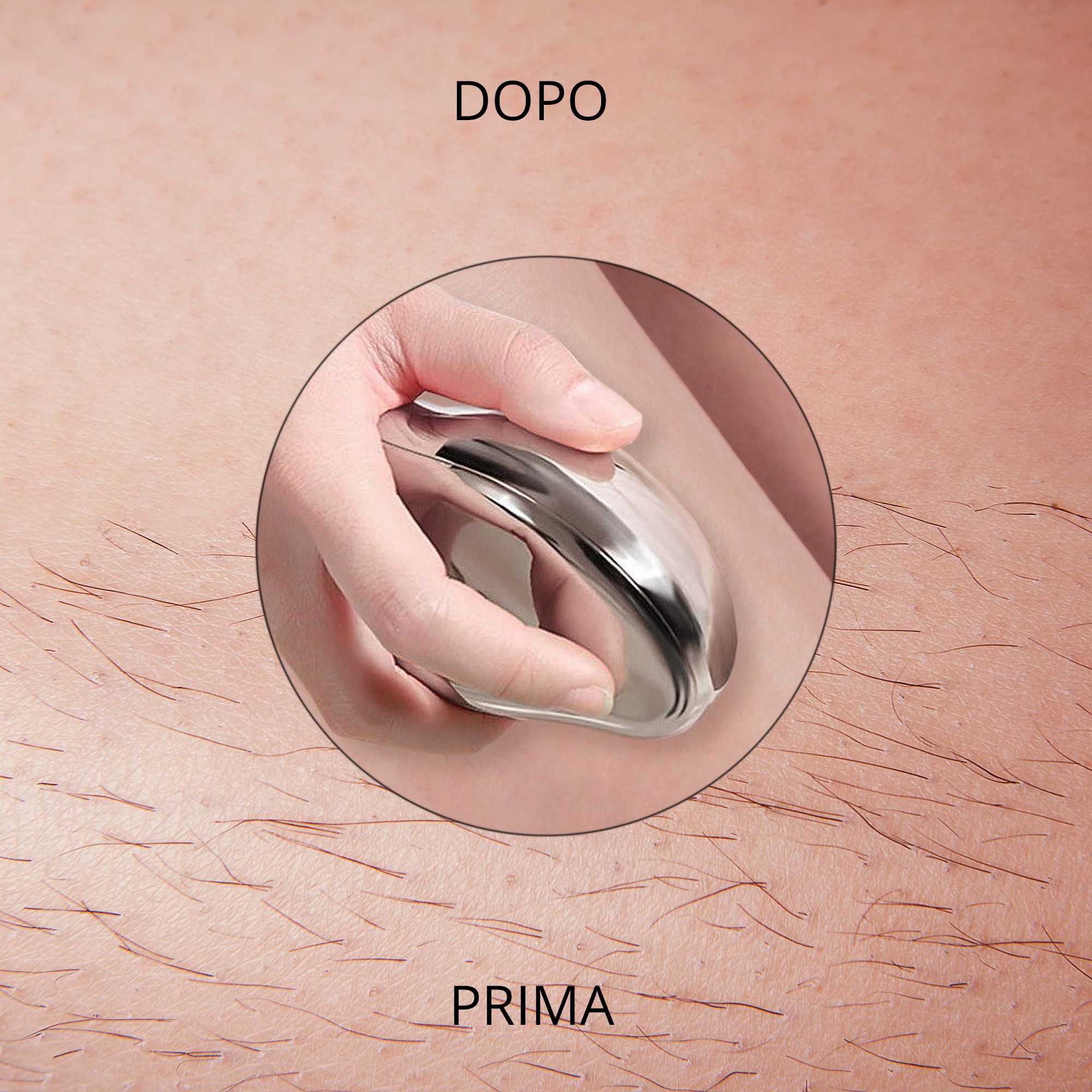 Primo piano di un epilatore in mano sulla pelle. Scritte: PRIMA e DOPO.