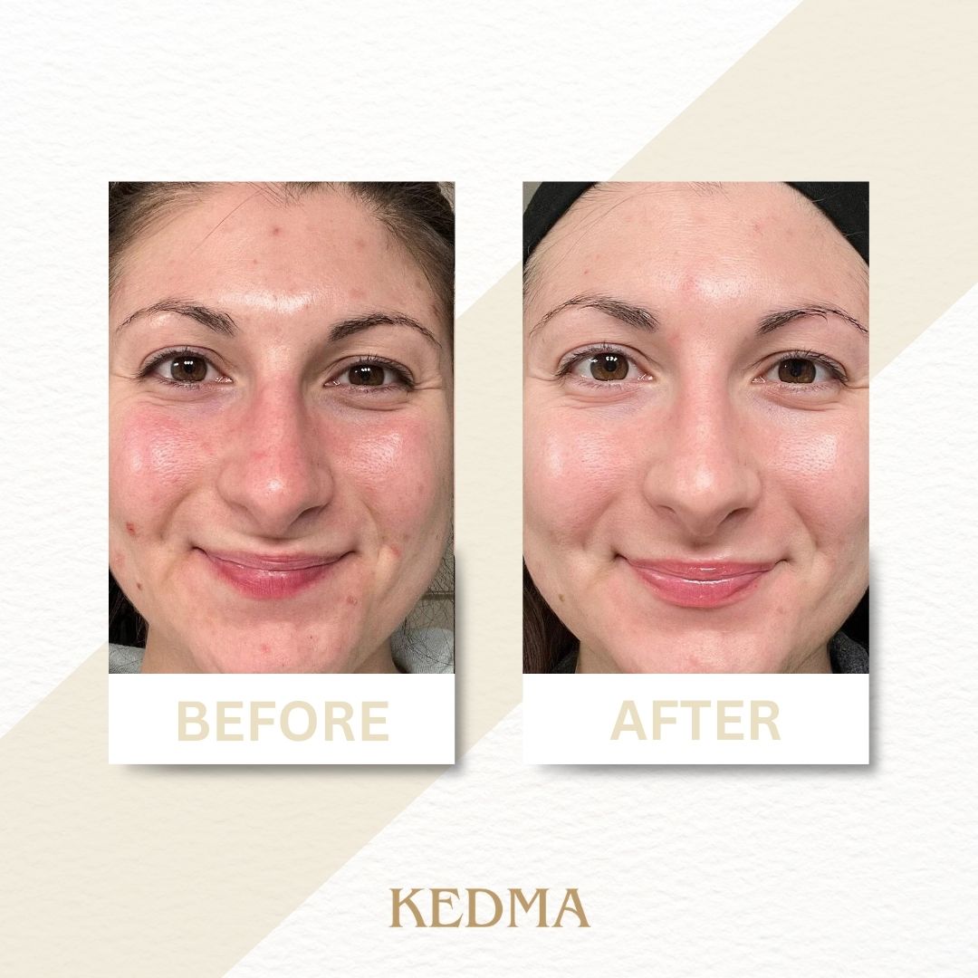 Kedma - Tonico Viso con Aloe Vera e Minerali del Mar Morto
