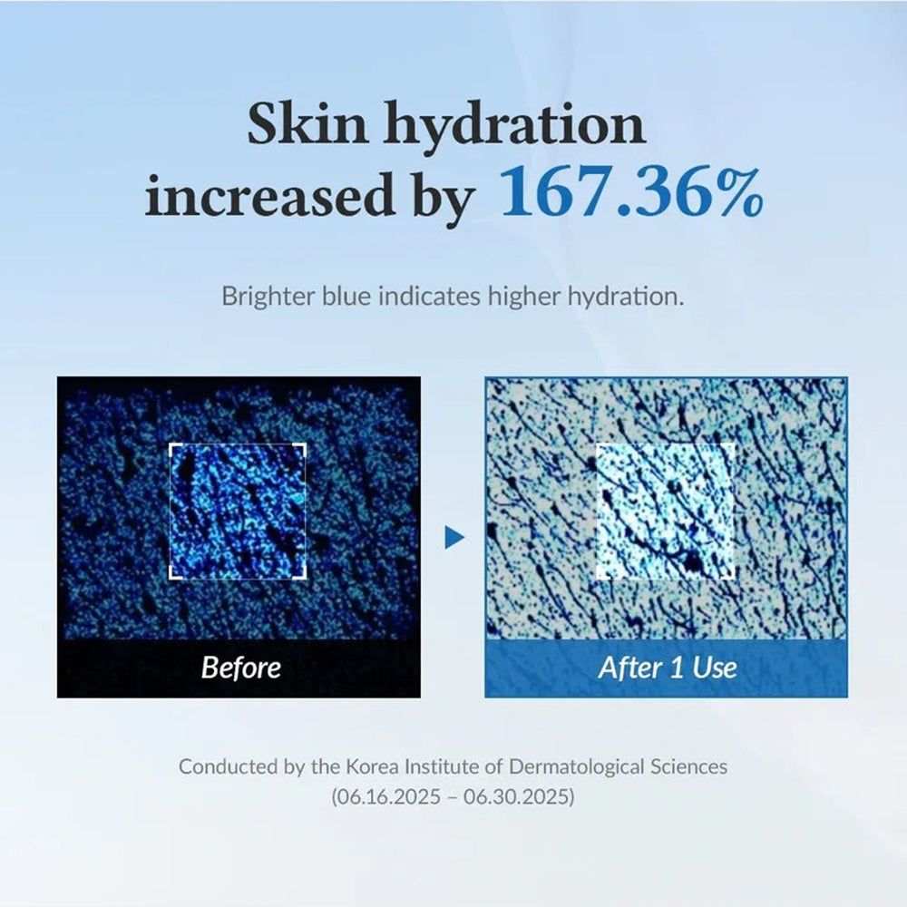 Confronto prima-dopo. Idratazione della pelle aumentata del 167,36%. Immagini blu microscopiche. Testo: Korea Institute of Dermatological Sciences.
