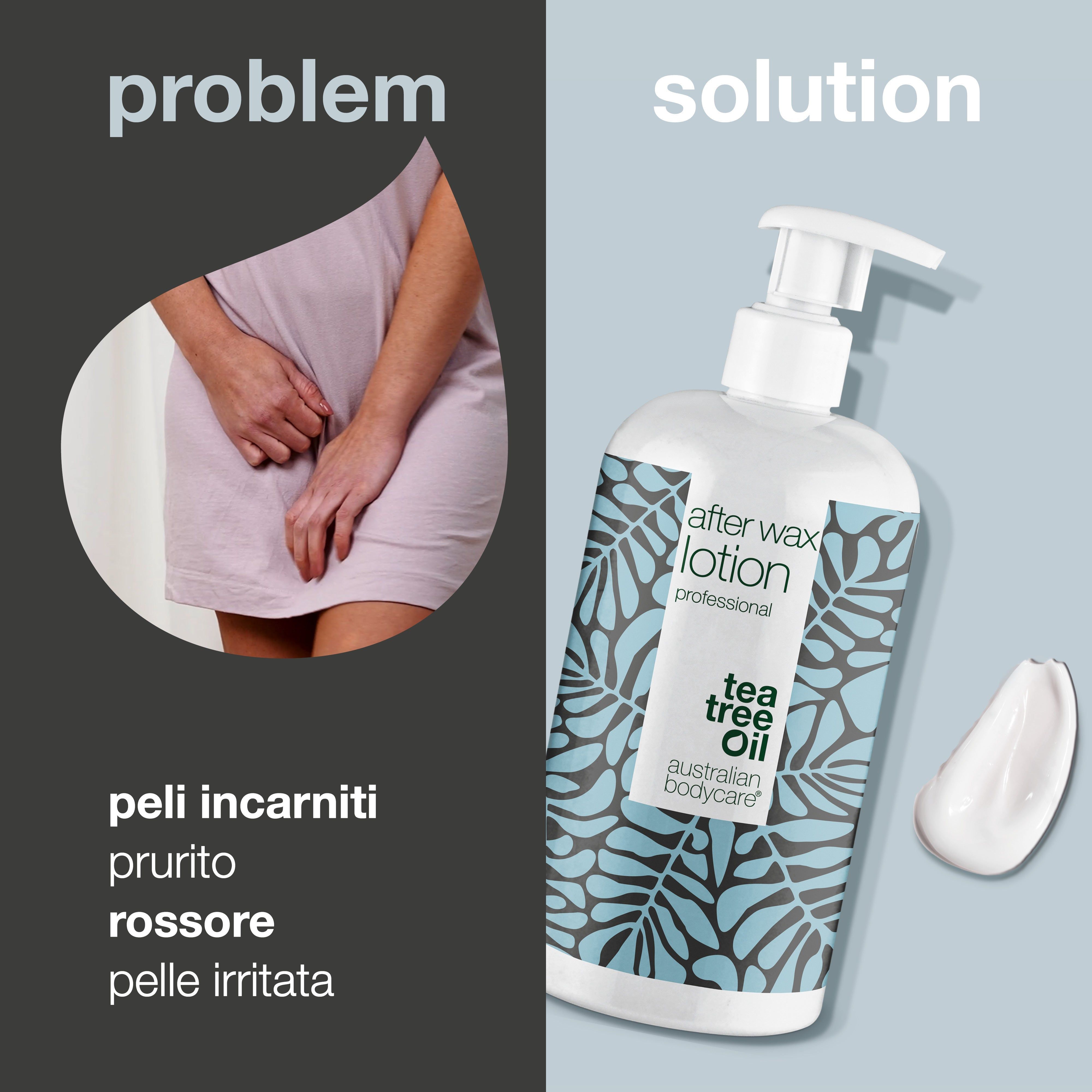 Confronto: problema (gambe) vs. soluzione (flacone After Wax Lotion). Testo: peli incarniti, prurito, rossore, pelle irritata.