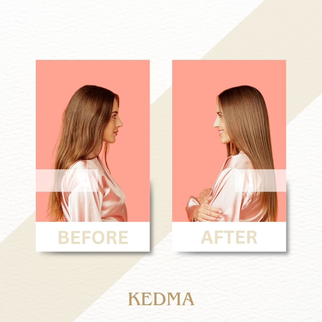 Kedma - Stimolatore di Crescita Radicale