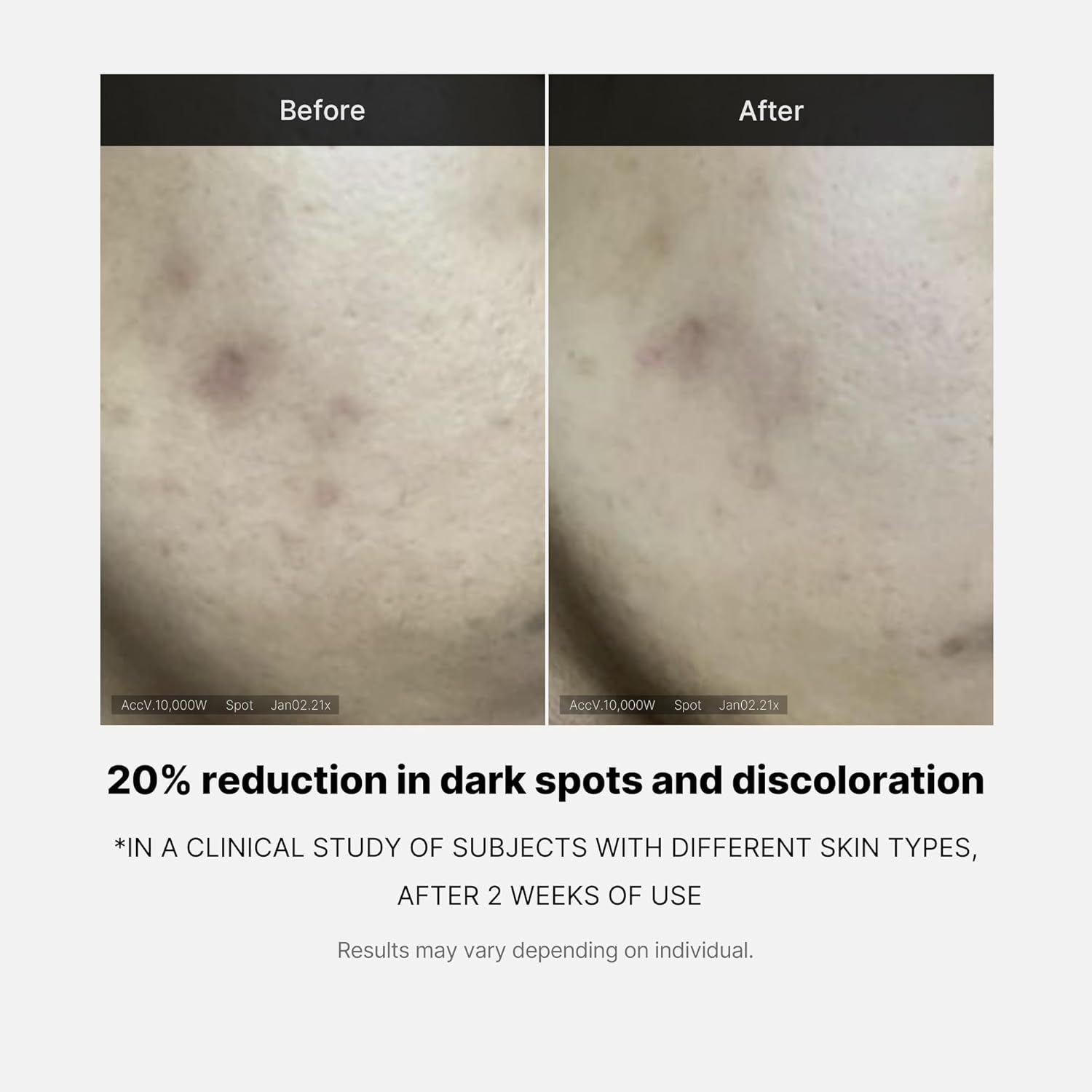 Confronto prima-dopo della pelle. Testo: Riduzione del 20% delle macchie scure. Studio dopo 2 settimane. Risultati variabili.