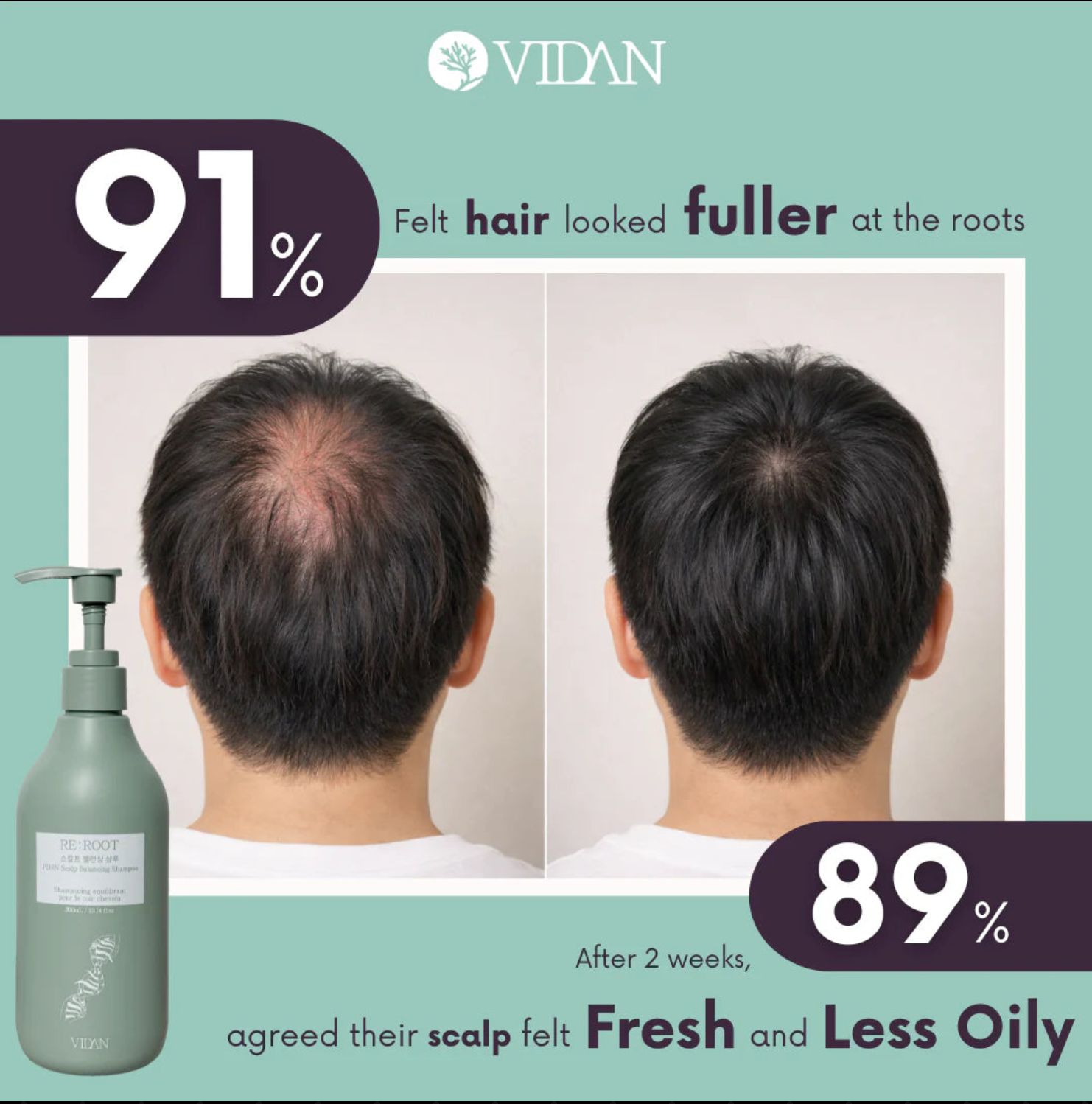 RE:ROOT – PDRN Scalp Balancing Shampoo