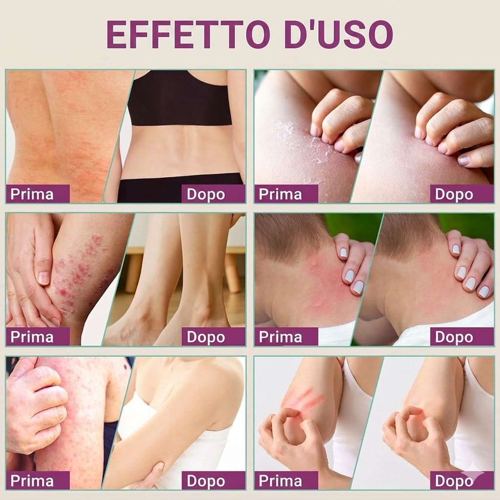 LMNOOP crema anti-prurito formula intensa