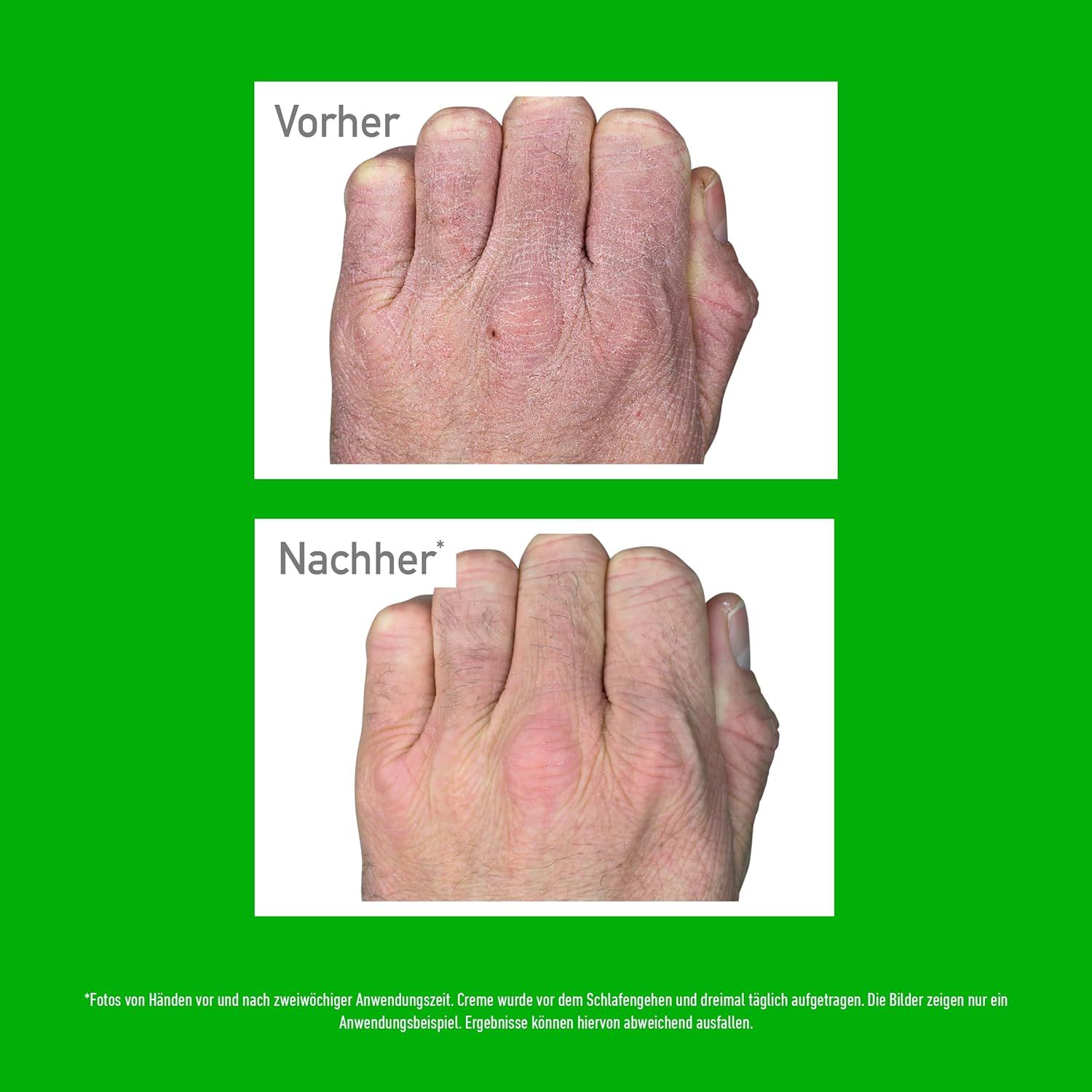 Confronto prima/dopo di mani secche dopo l'applicazione di O'Keeffe's Working Hands Crema mani.