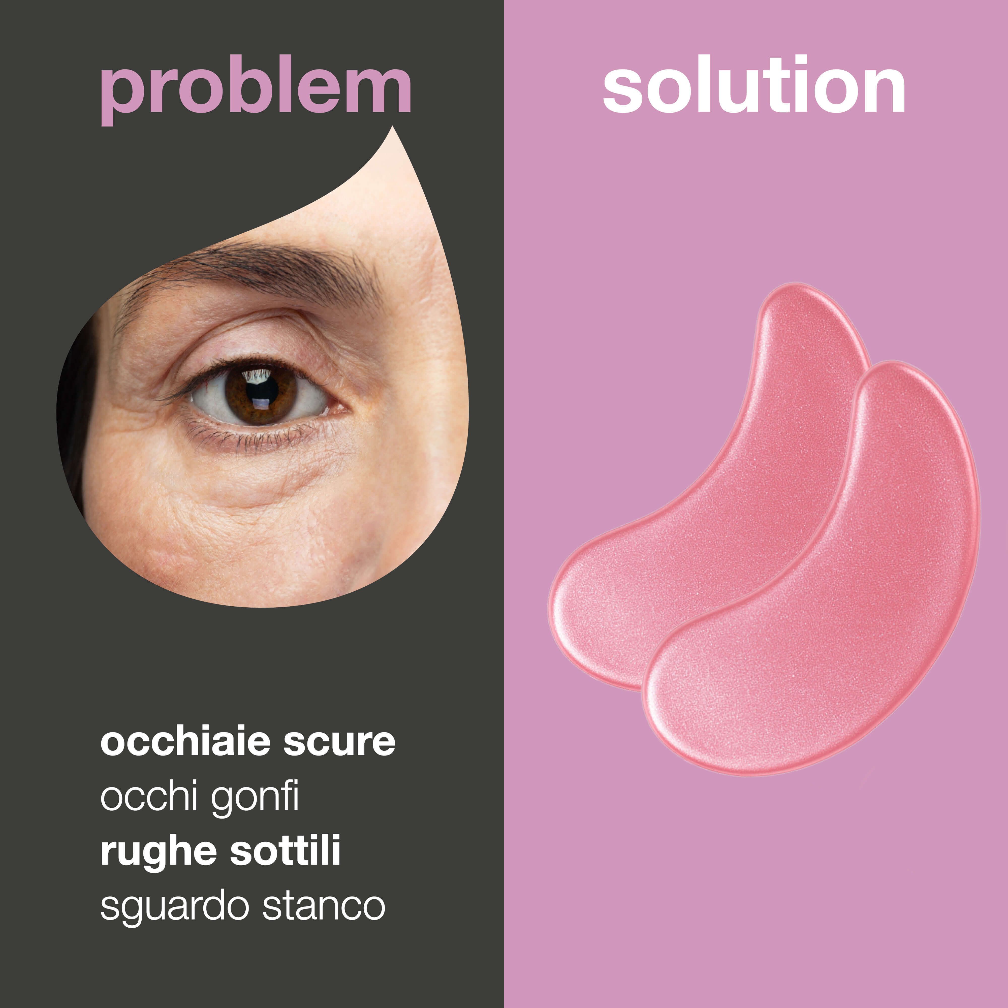 Foto: Problema e soluzione. A sinistra: occhio con occhiaie. A destra: due patch occhi rosa.