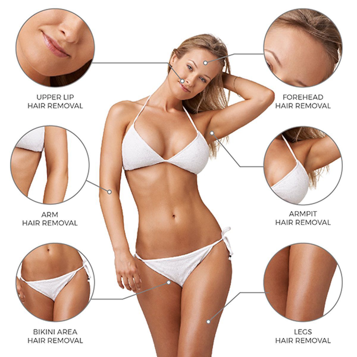 Donna in bikini bianco, schema delle aree di depilazione: labbro superiore, braccio, ascella, bikini, gambe, fronte.