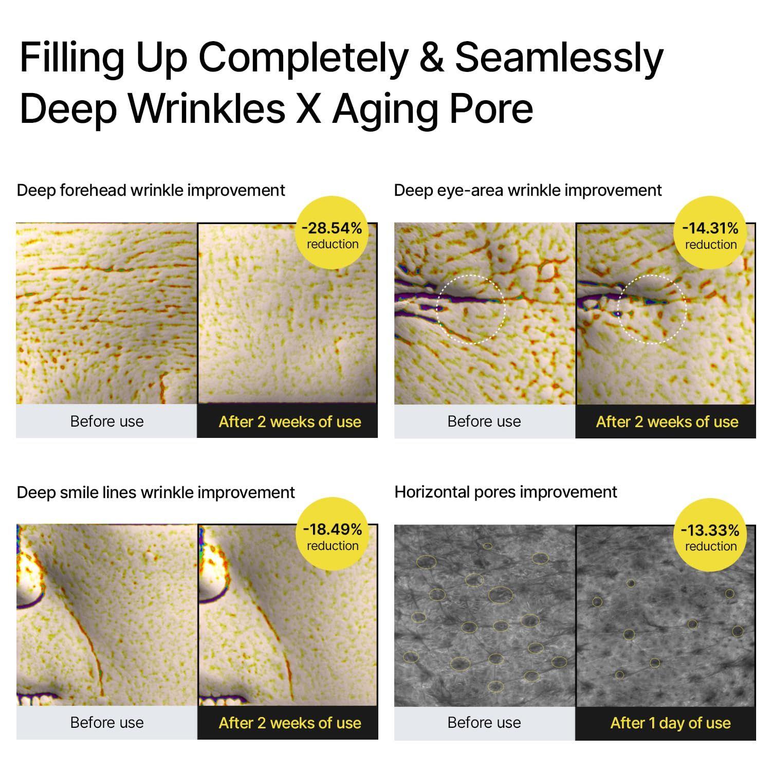 Immagini prima-dopo mostrano miglioramenti delle rughe e dei pori dopo l'uso. Riduzioni percentuali visualizzate.