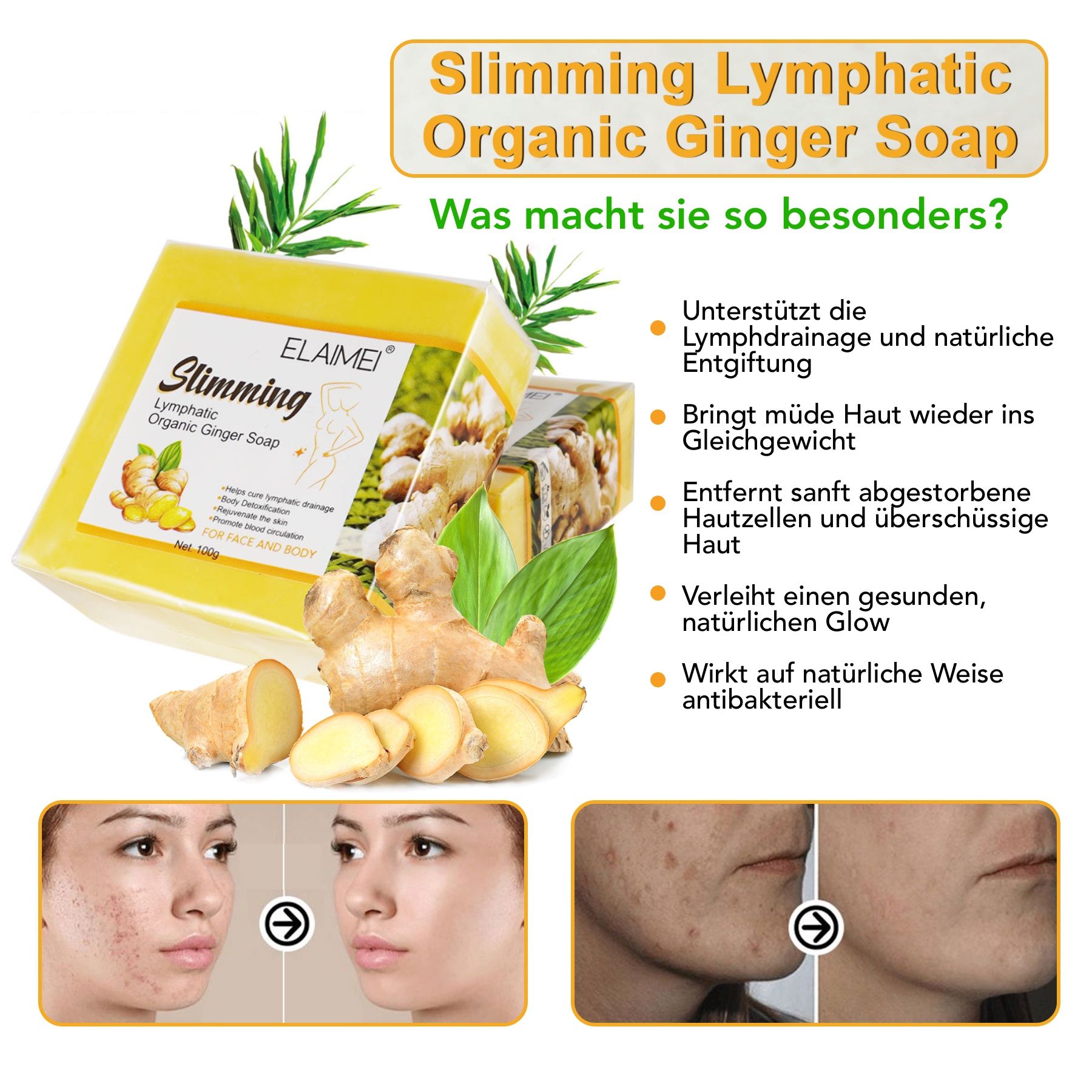 Sapone giallo, zenzero e testo. Testo: Slimming Lymphatic Organic Ginger Soap. Immagini prima e dopo.