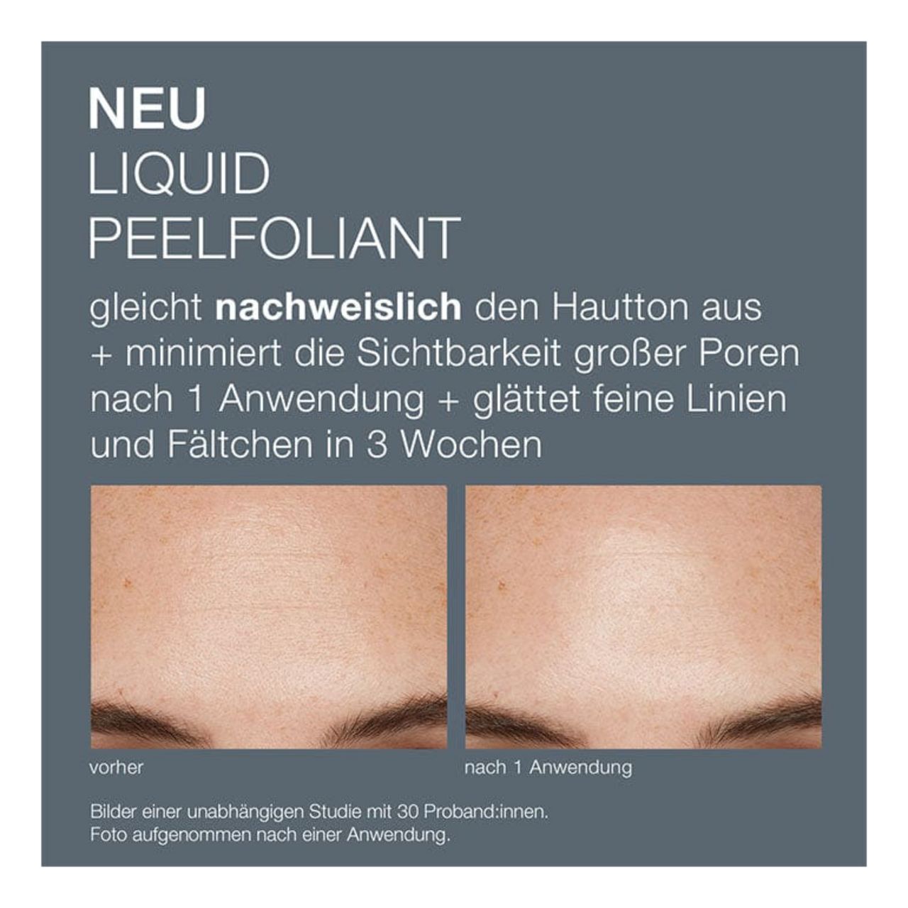 Dermalogica Liquid Peelfoliant