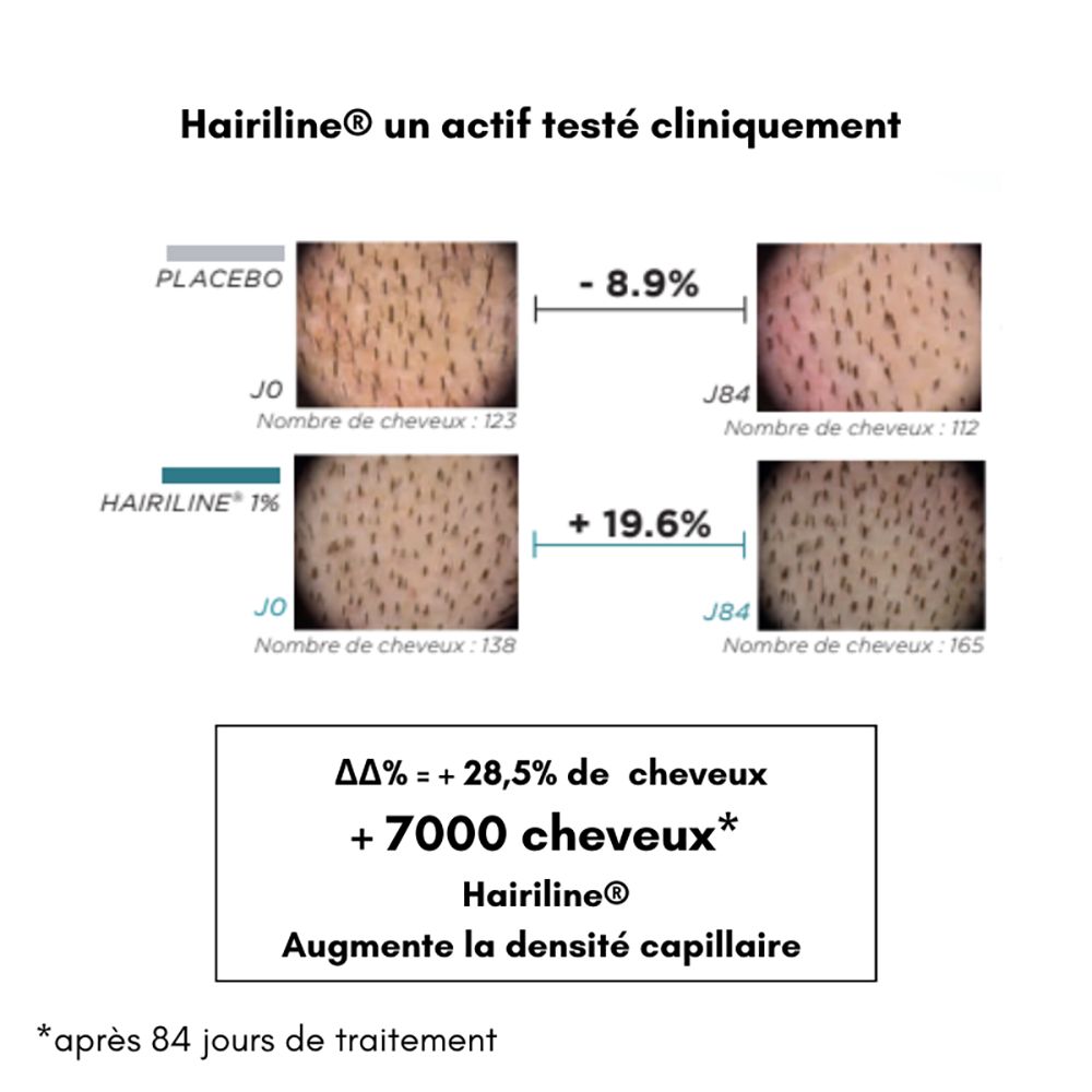 Confronto crescita capelli. Placebo vs. Hairiline 1%. Grafico mostra la variazione della densità. Testo: +28,5% di capelli, +7000 capelli, aumenta la densità.