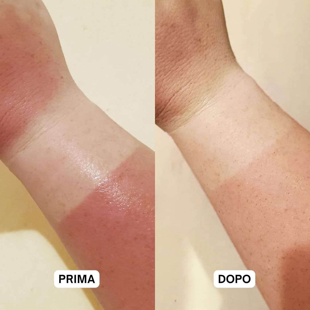 Due braccia. Sinistra: pelle scottata dal sole. Destra: pelle dopo l'applicazione. Testo: Prima, Dopo.