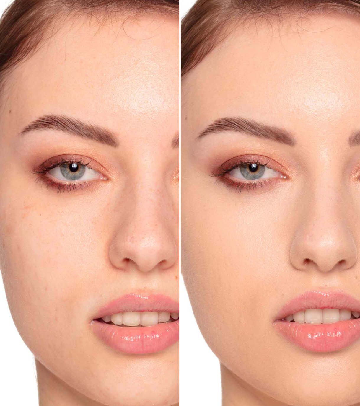 Confronto di un lato del viso prima e dopo l'applicazione del trucco, che copre le imperfezioni della pelle.