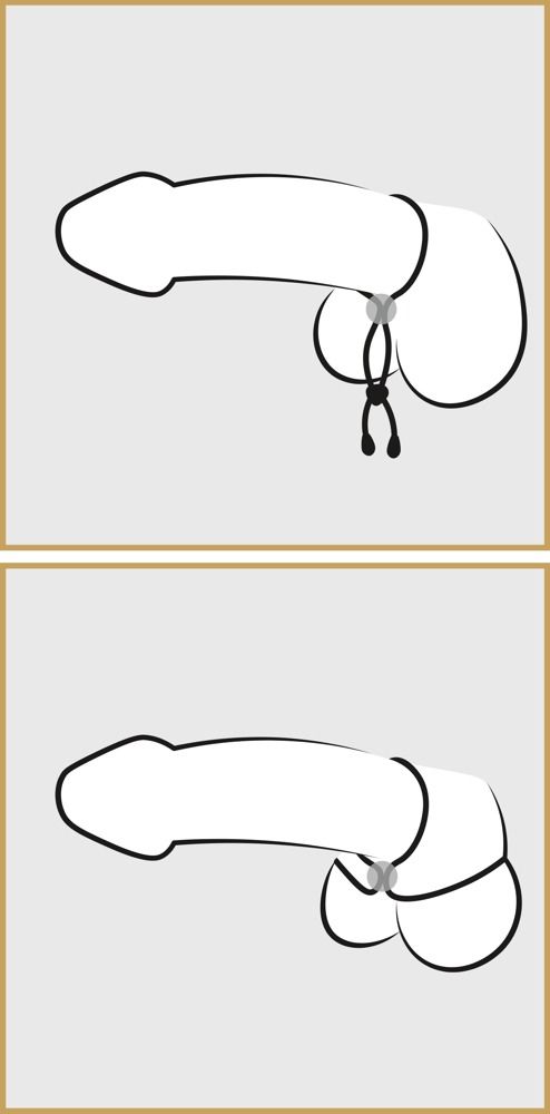 Due rappresentazioni schematiche di un anello per pene e scroto. Linee nere su sfondo grigio e beige.