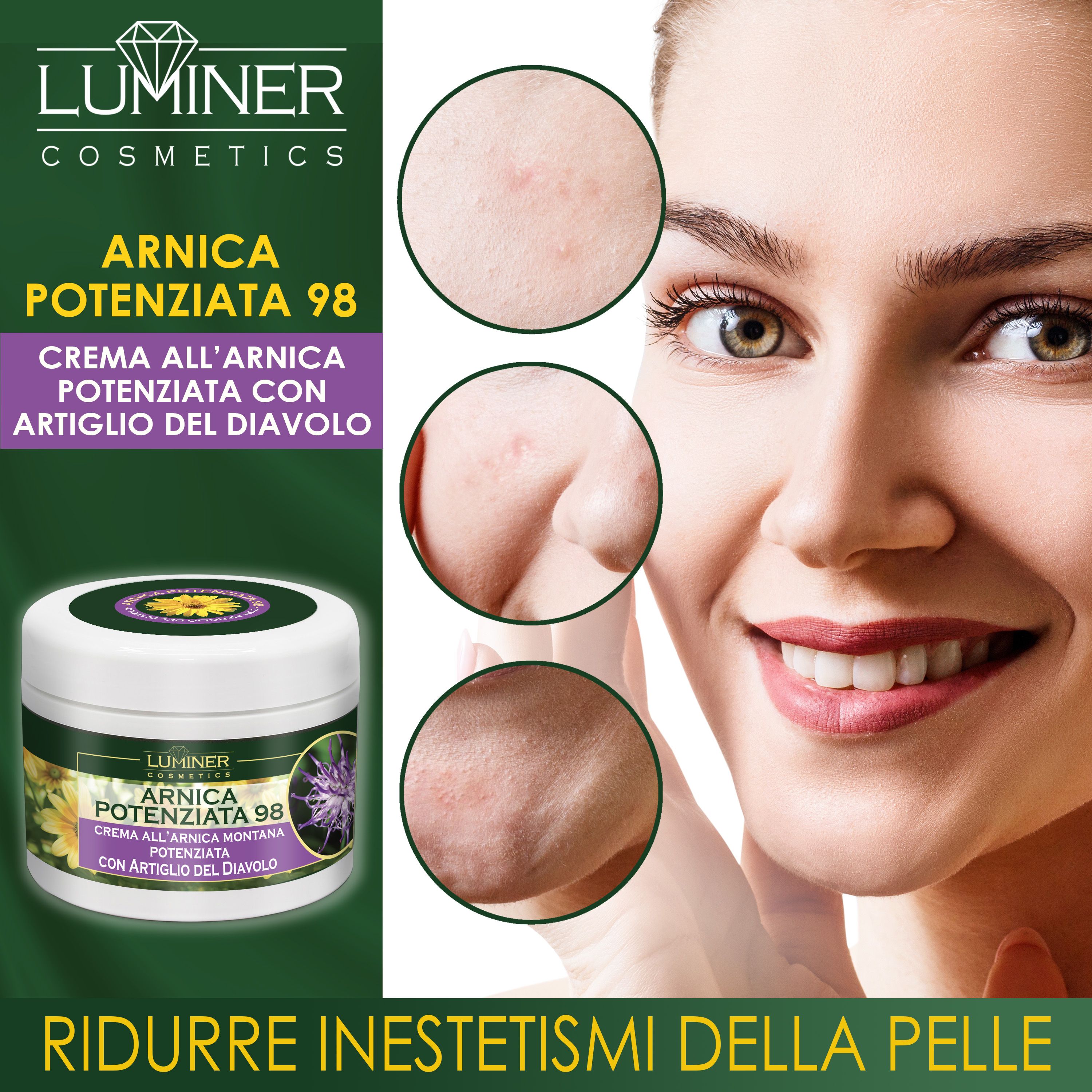 Zone di pelle con imperfezioni. Accanto, un vasetto di LUMINER ARNICA POTENZIATA 98.