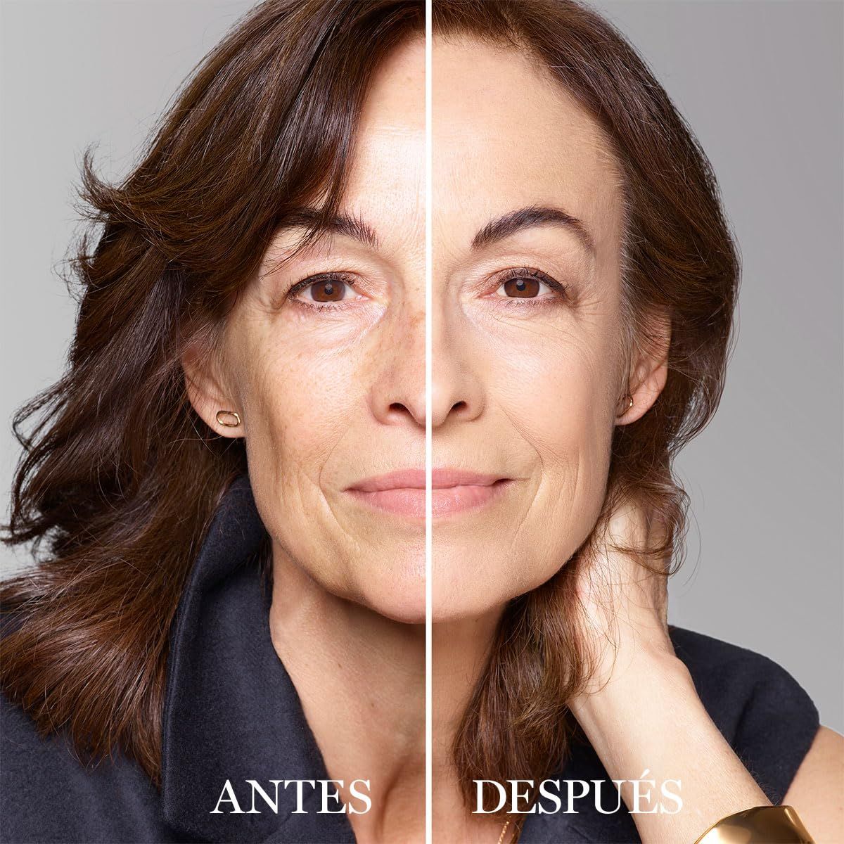 Viso di donna, diviso in prima e dopo. Sinistra: Prima. Destra: Dopo.