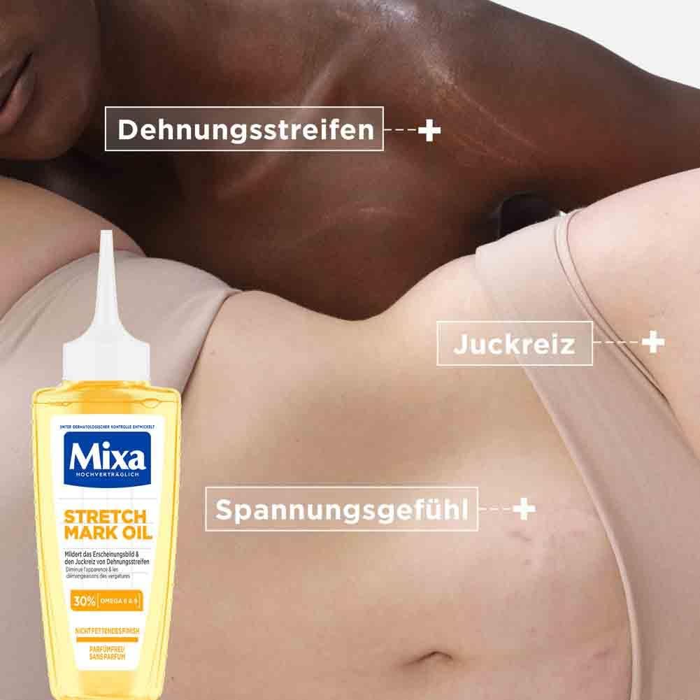 Flacone Mixa Stretch Mark Oil accanto alla pelle con smagliature. Testo: Smagliature, prurito, sensazione di tensione.