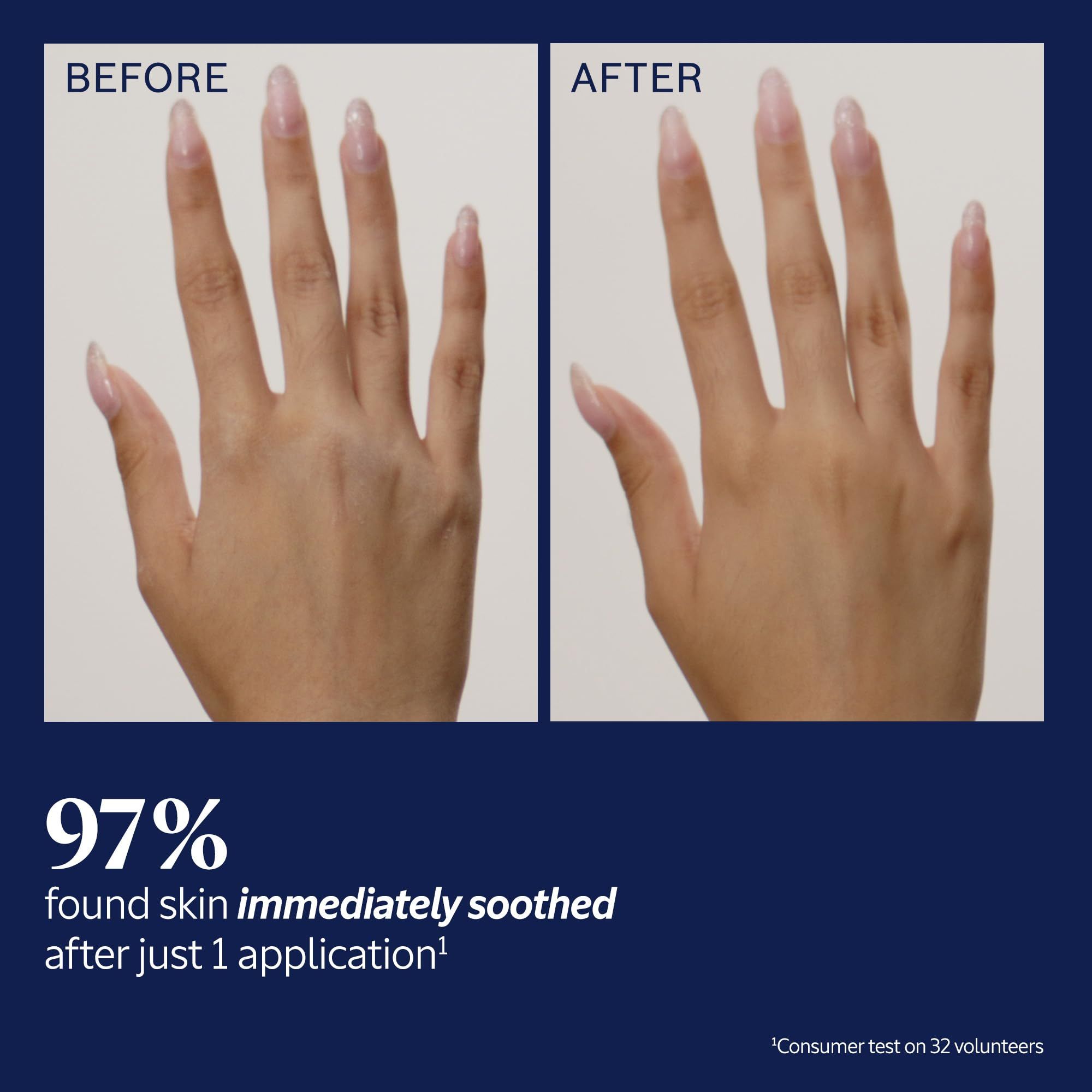 Confronto mani prima e dopo l'applicazione di crema mani, con testo sull'idratazione della pelle.