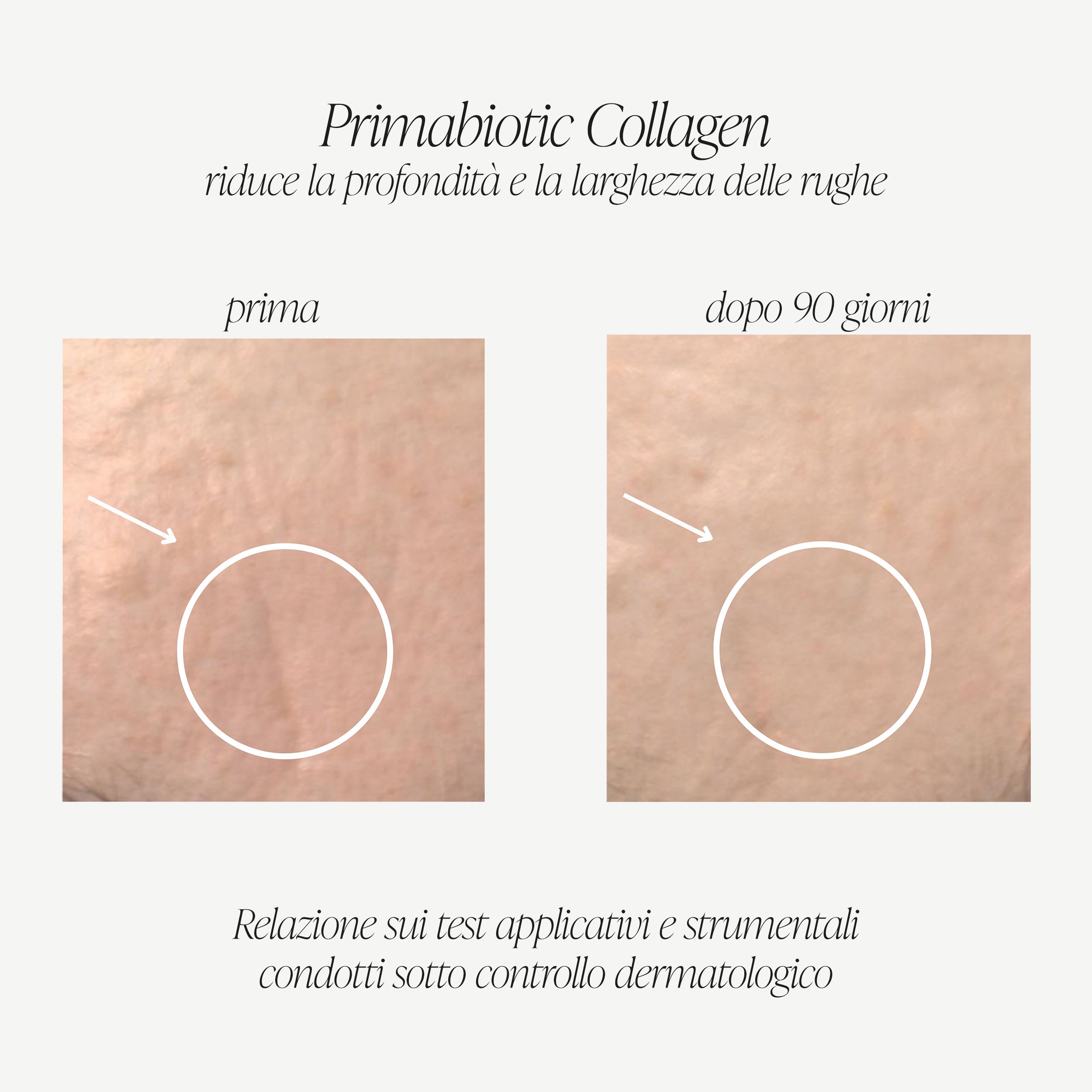 Confronto prima-dopo della pelle. Mostra la riduzione delle rughe dopo 90 giorni di utilizzo di Primabiotic Collagen.