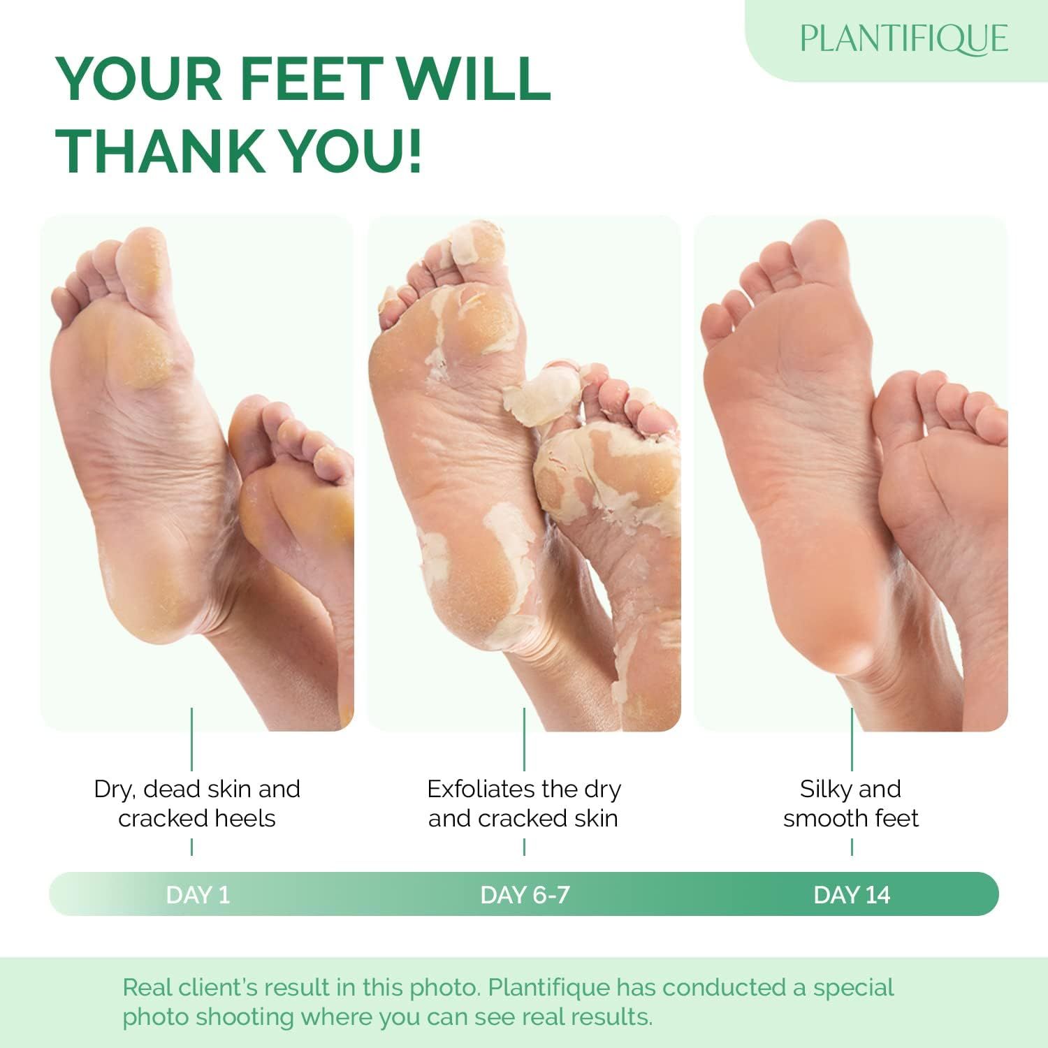 Tre fasi del trattamento dei piedi: Giorno 1: talloni secchi e screpolati. Giorno 6-7: desquamazione. Giorno 14: piedi setosi e lisci. Testo: Plantifique.