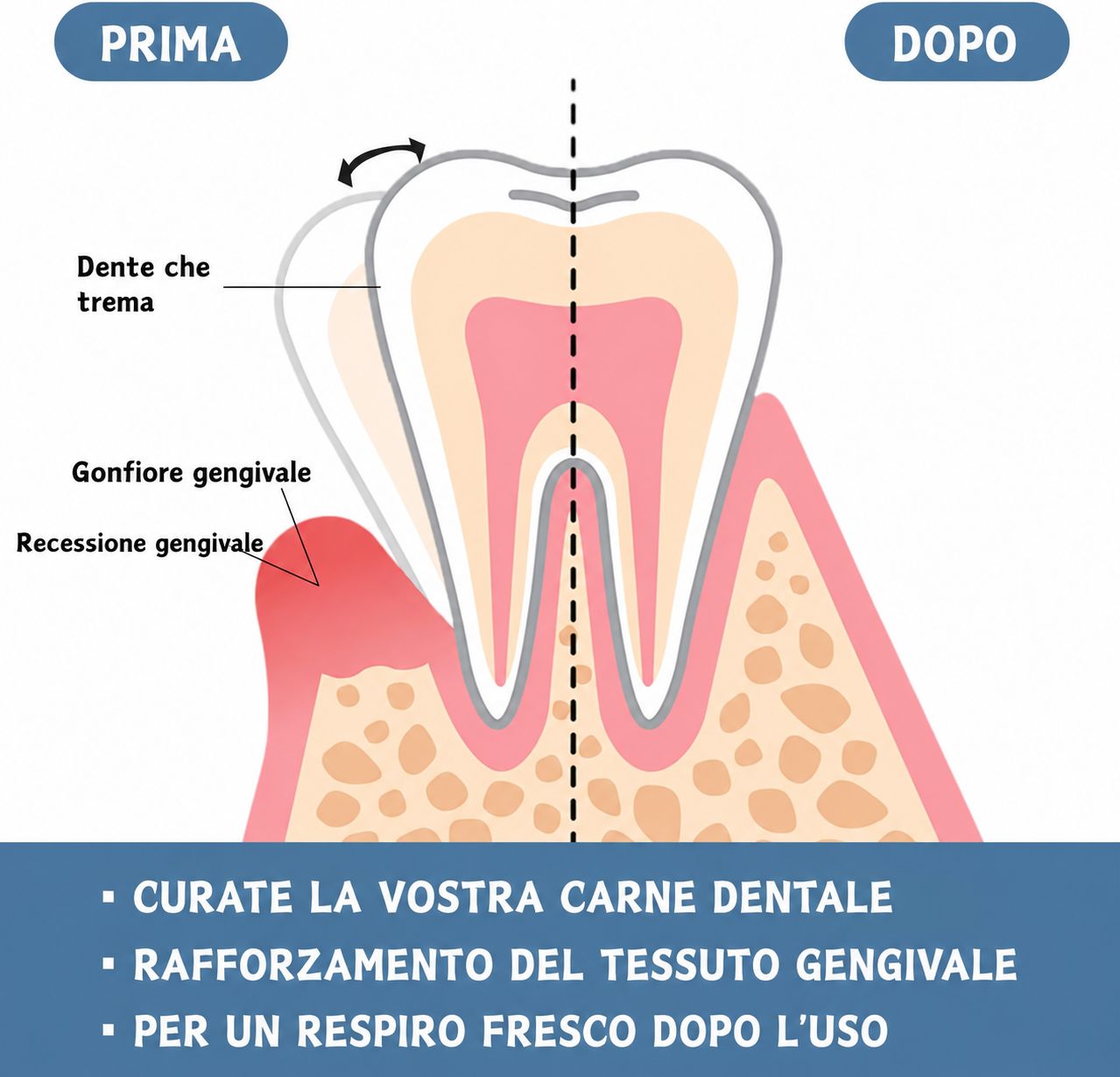 SUMMISHI Spray e Gocce Riparatrici per le Gengive