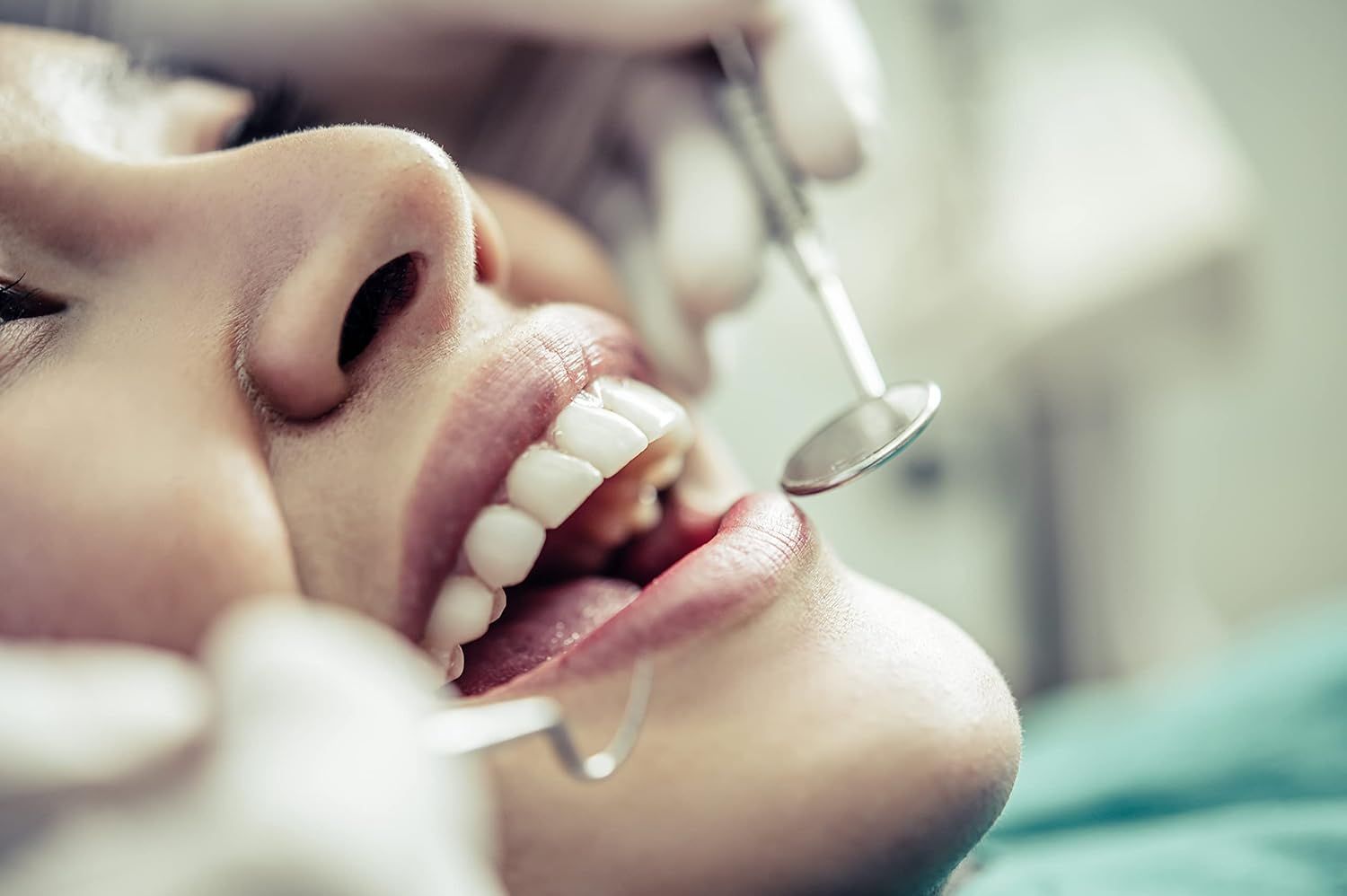 Bocca di una persona con bocca aperta. Strumenti del dentista in uso. Denti visibili.
