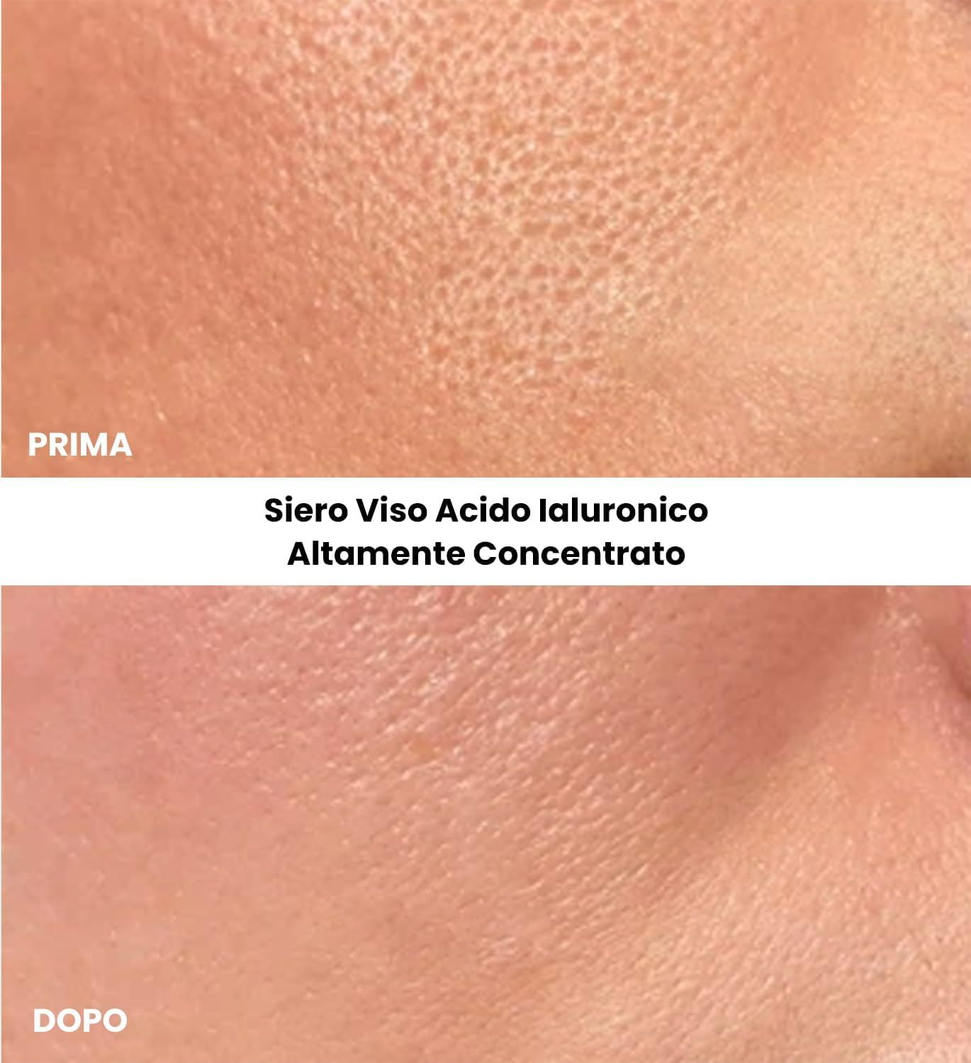 Confronto prima-dopo della pelle del viso. Testo: Siero Viso Acido Ialuronico Altamente Concentrato.