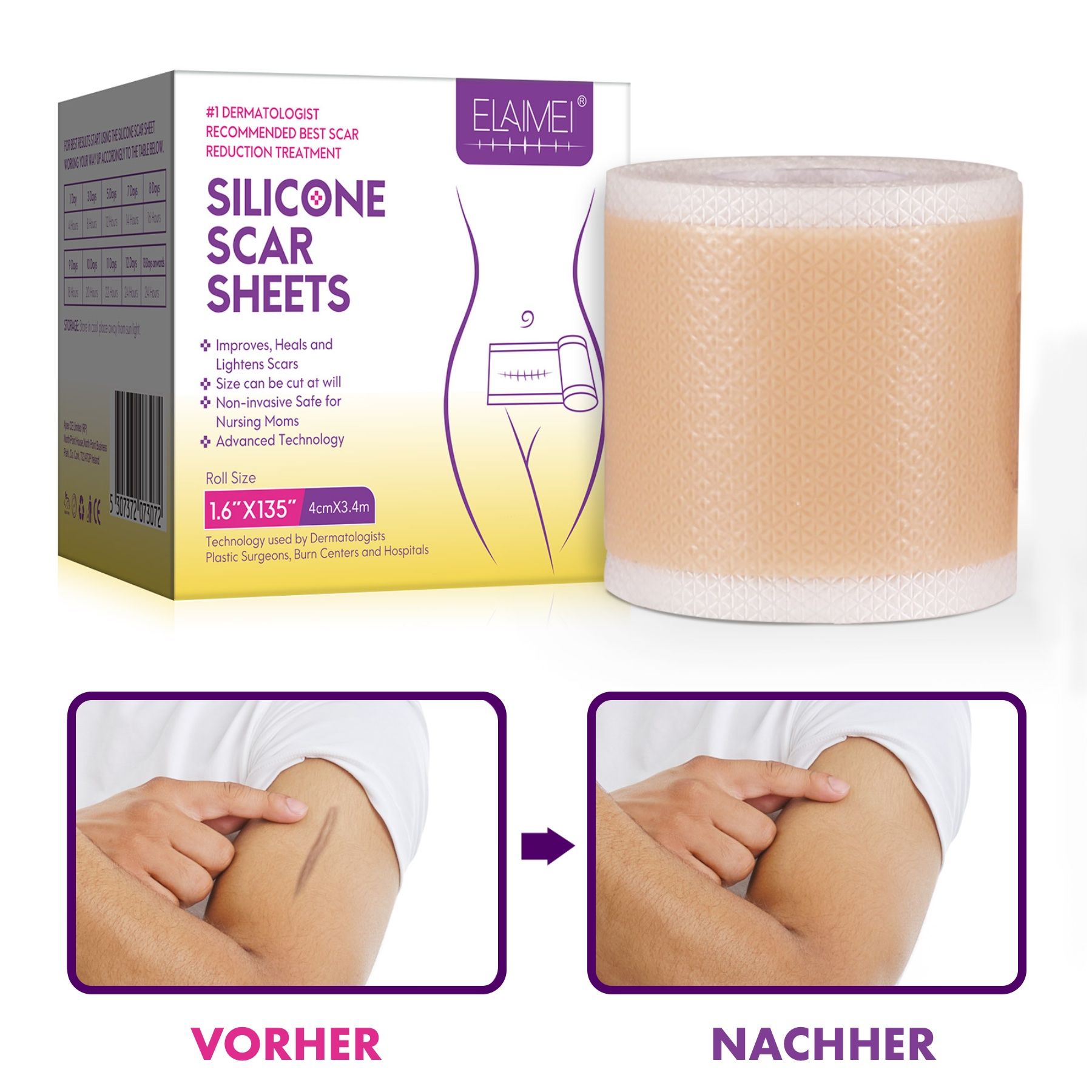 Confezione e rotolo di cerotti in silicone. Confronto prima-dopo: braccio con cicatrice, poi stesso punto senza cicatrice.