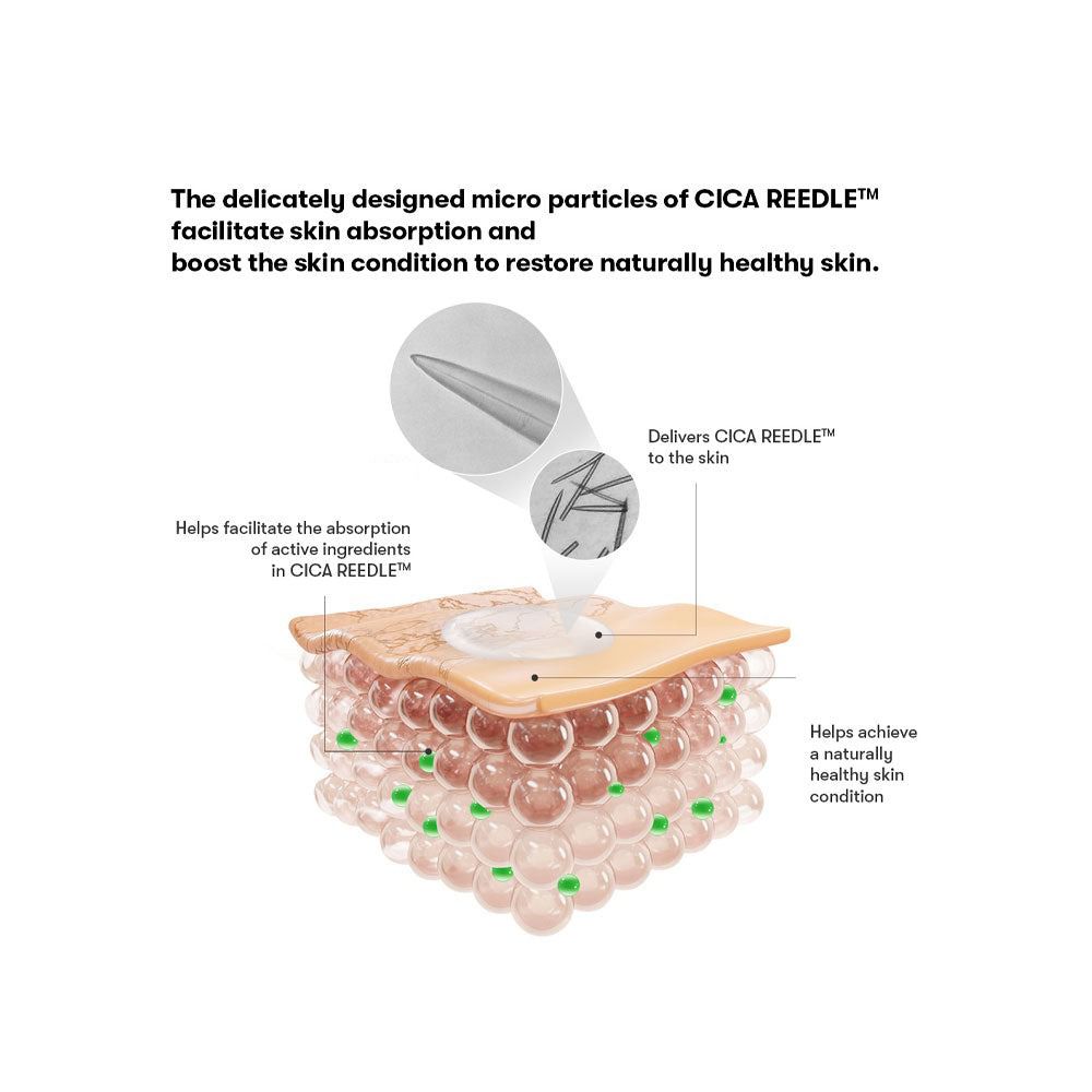 Rappresentazione schematica dei microaghi. Strati della pelle con microaghi che rilasciano principi attivi. Rappresentazione della salute della pelle.