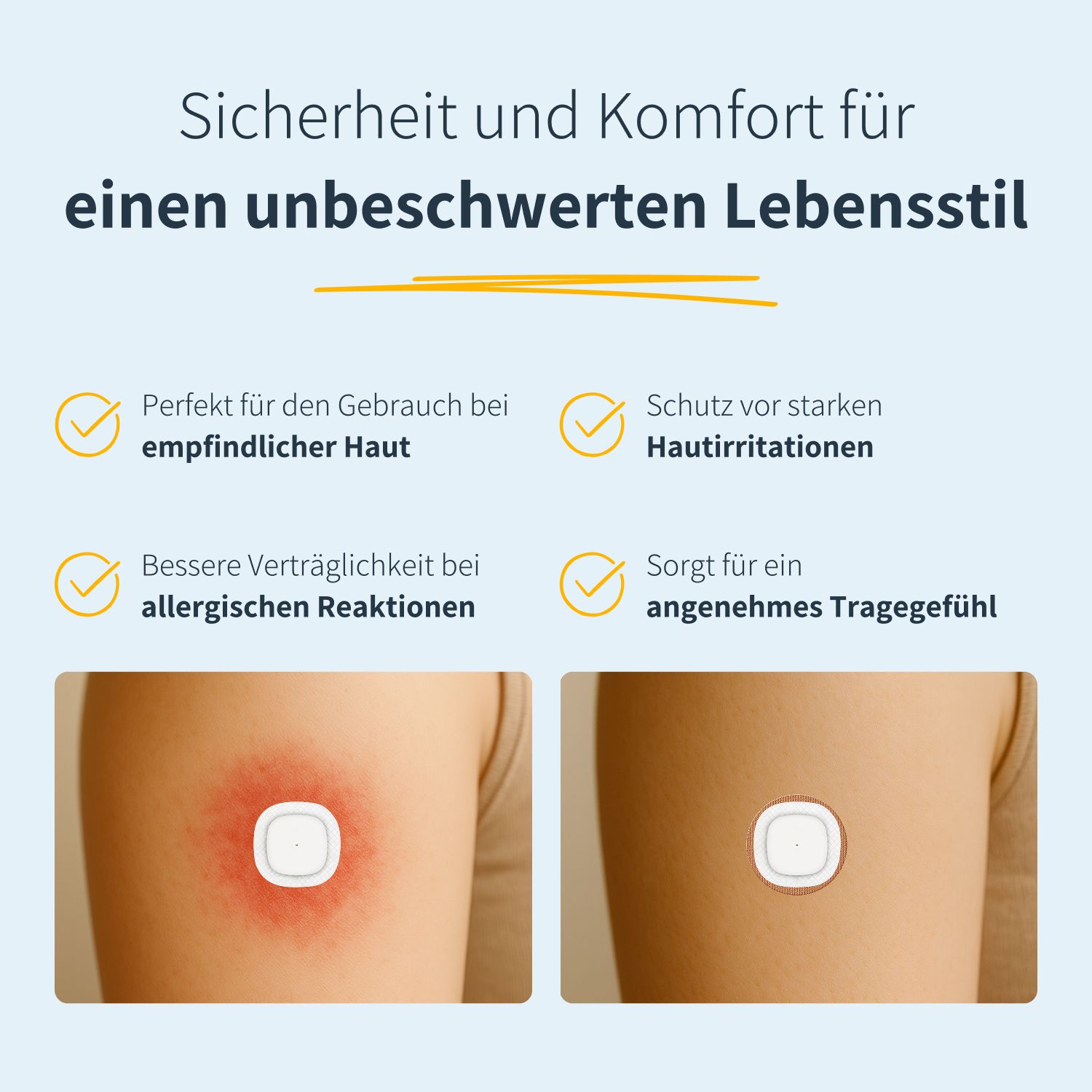 Due braccia mostrano irritazioni cutanee e un cerotto. Il cerotto protegge e adatto a pelli sensibili.