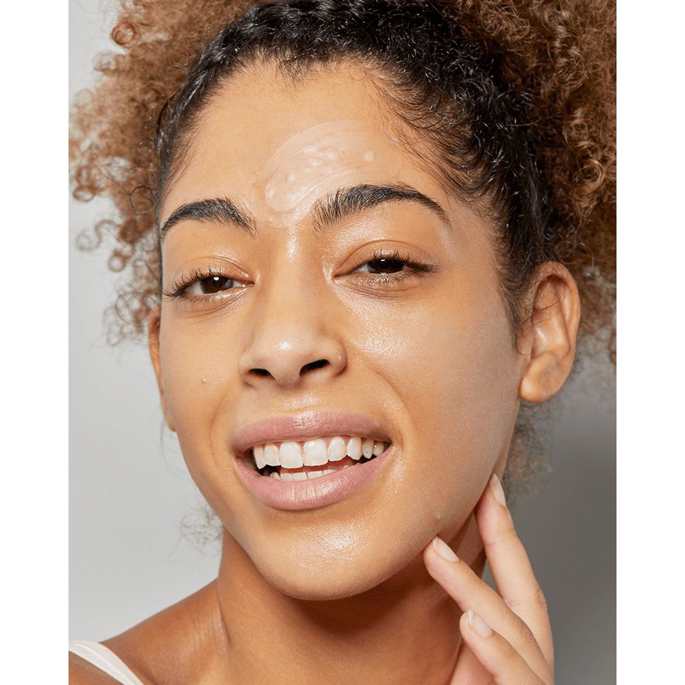 Primo piano di una persona con un cerotto per l'acne sulla guancia. La persona sorride. La pelle è lucida.