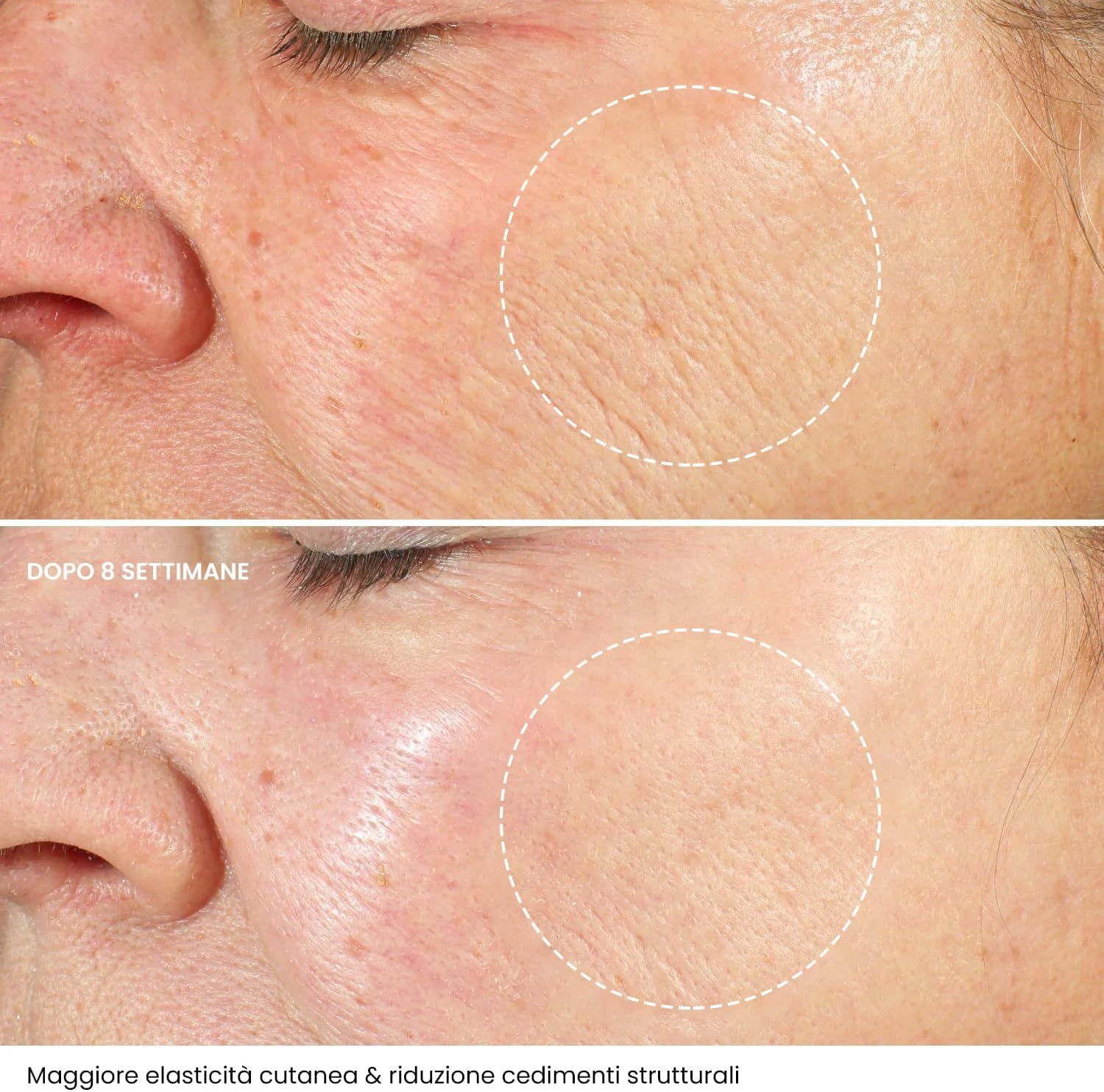 Pelle del viso prima e dopo 8 settimane. Miglioramento visibile. Testo: Maggiore elasticità cutanea.