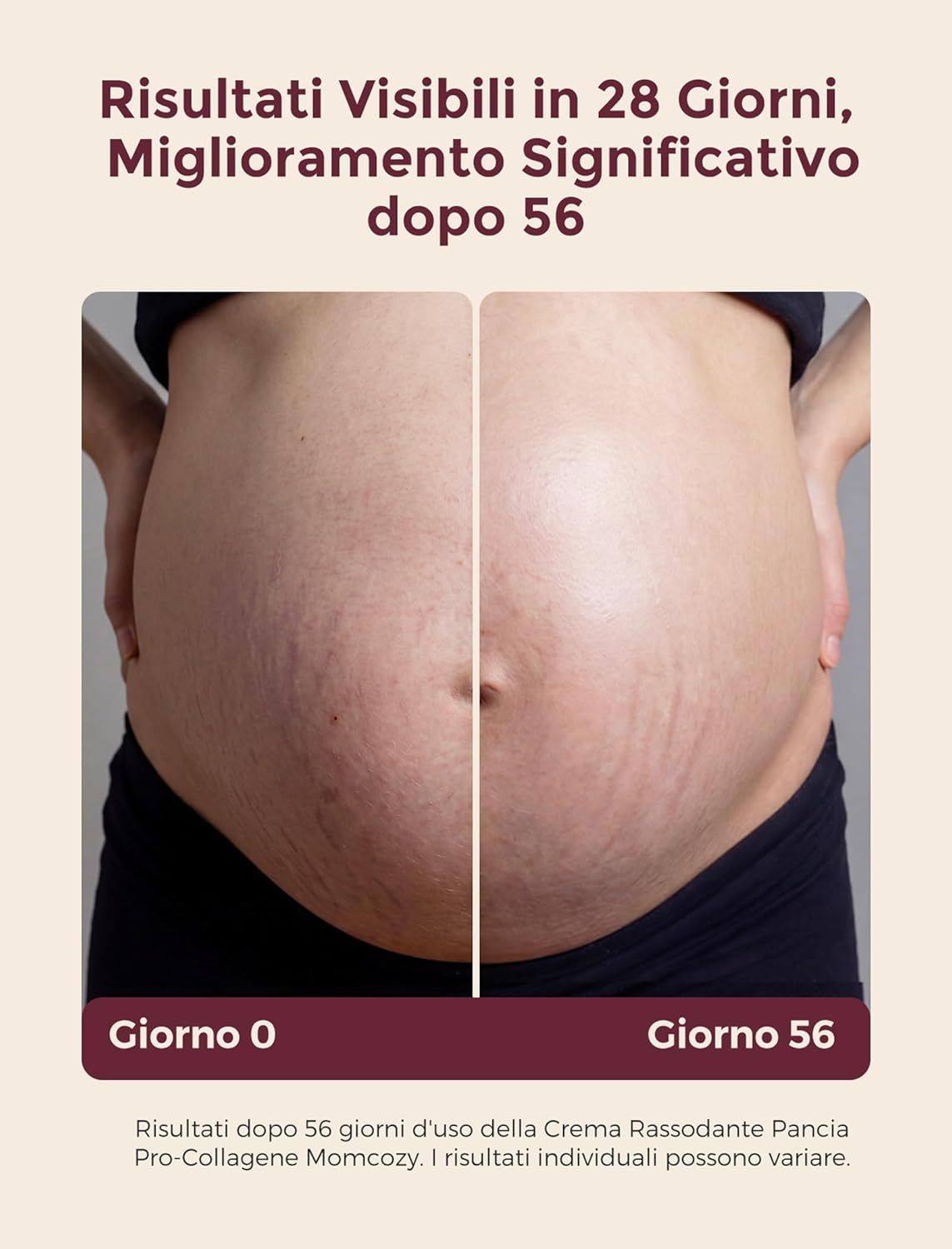 Crema gravidanza per la prevenzione delle smagliature Momcozy
