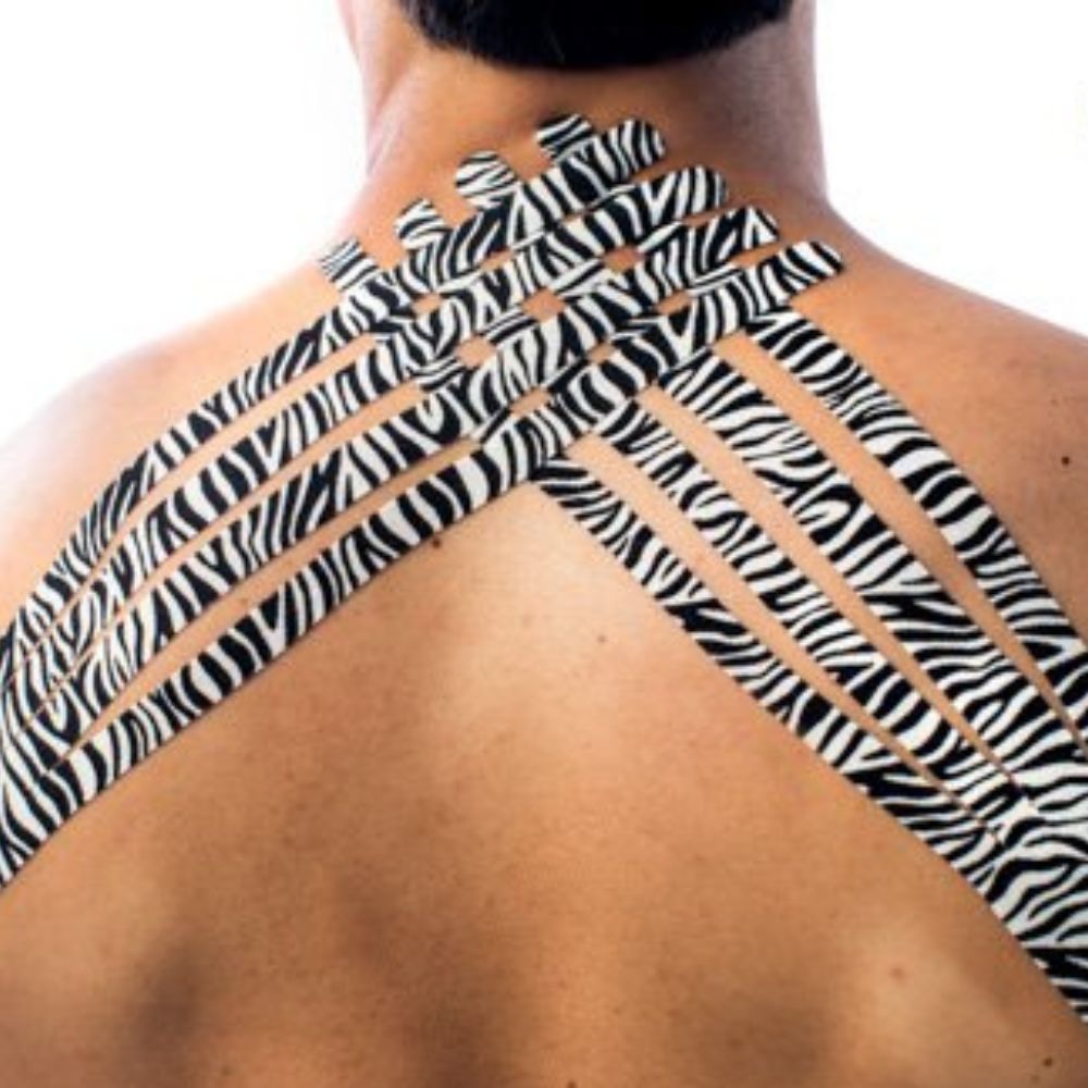 Kinesio tape zebrato applicato a onde sulla schiena di una persona.
