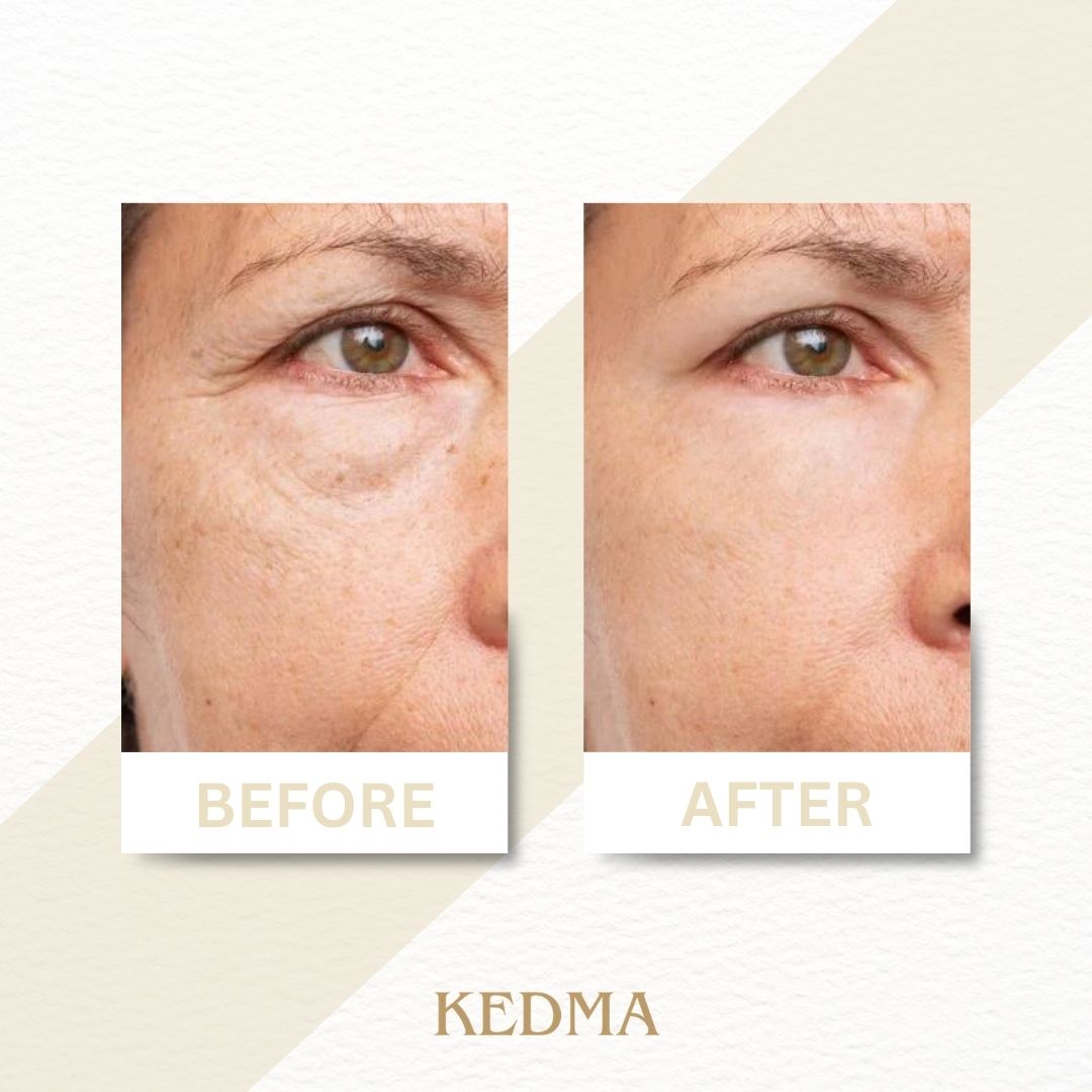 Kedma - Set Crema Giorno e Notte con Collagene e Minerali del Mar Morto