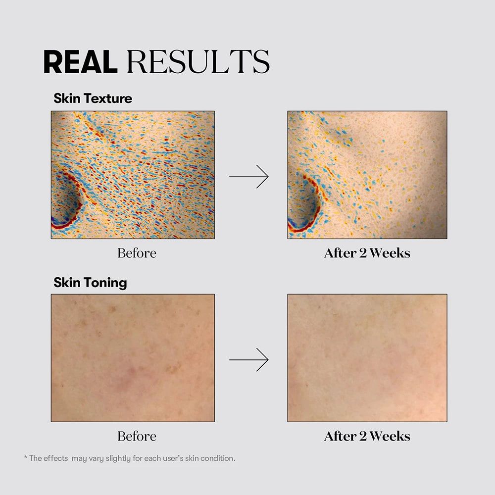 VT COSMETICS TX-Toning: Confronto prima e dopo della texture e del tono della pelle.