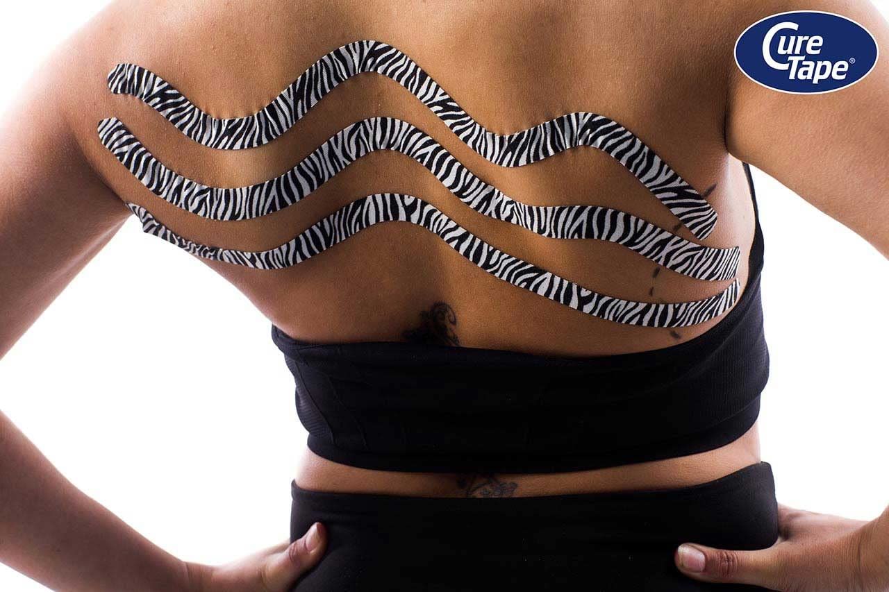 Schiena con tre strisce di kinesio tape zebrato. Sfondo bianco.