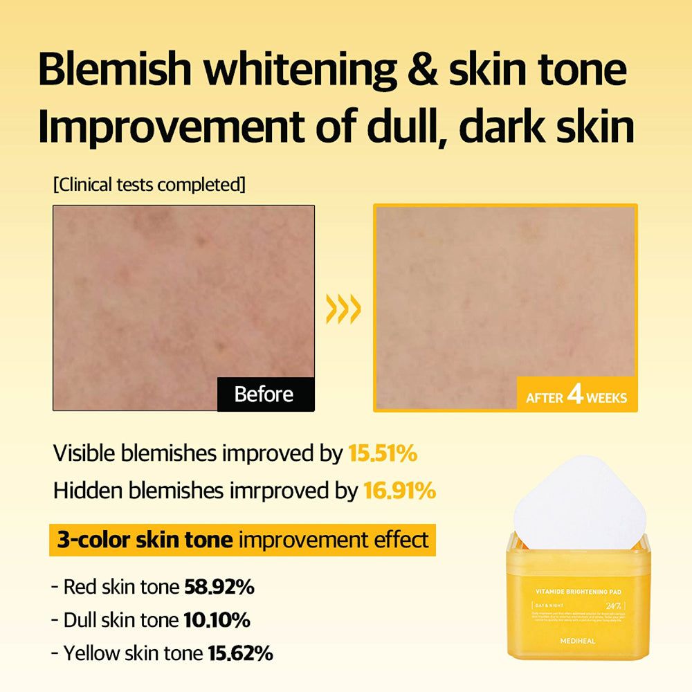 Confronto prima-dopo della pelle. Scatola gialla con pads. Testo: Vitamide Brightening Pad. Risultati: miglioramento delle imperfezioni e del tono.