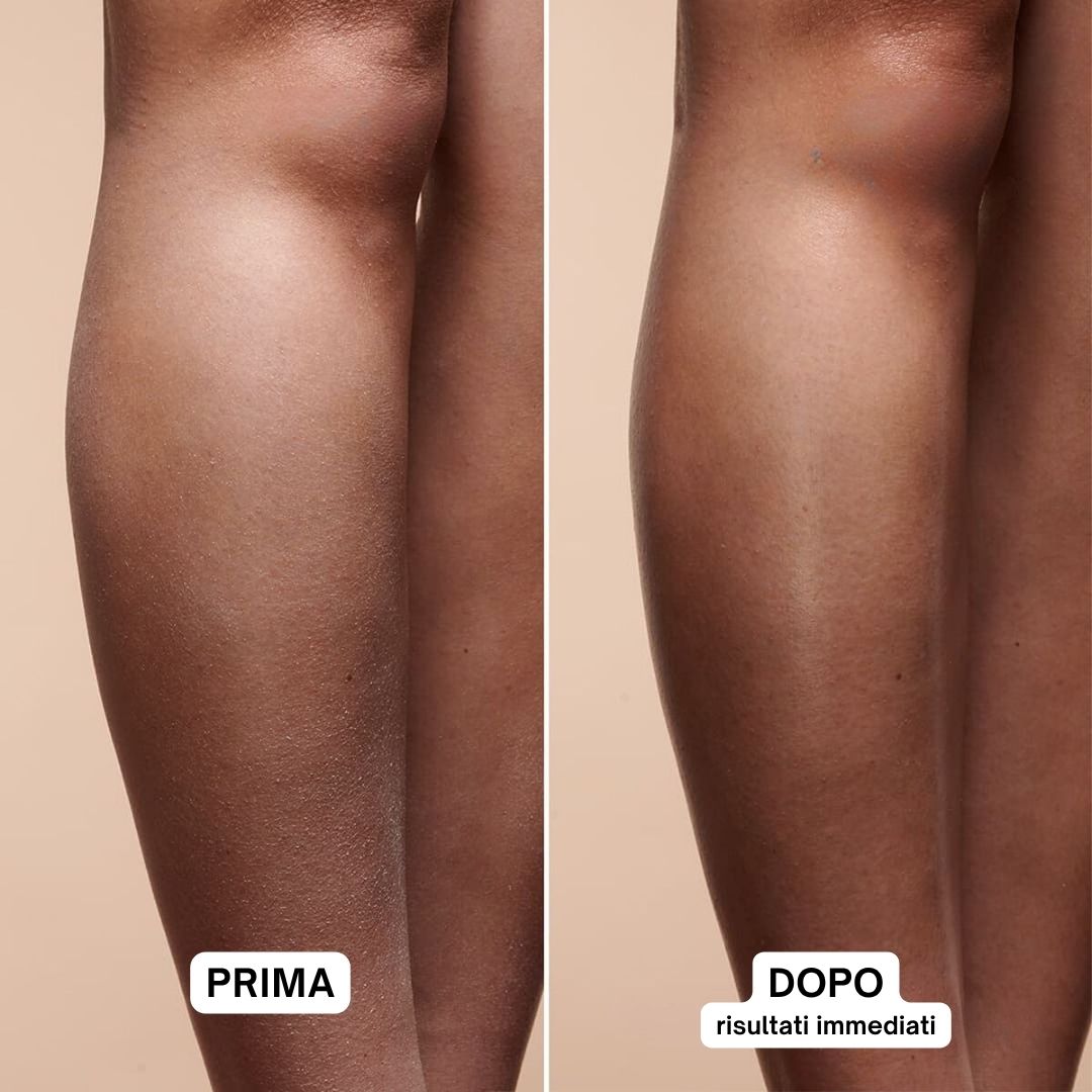 Gambe prima e dopo l'applicazione. Prima: pelle secca. Dopo: pelle liscia.