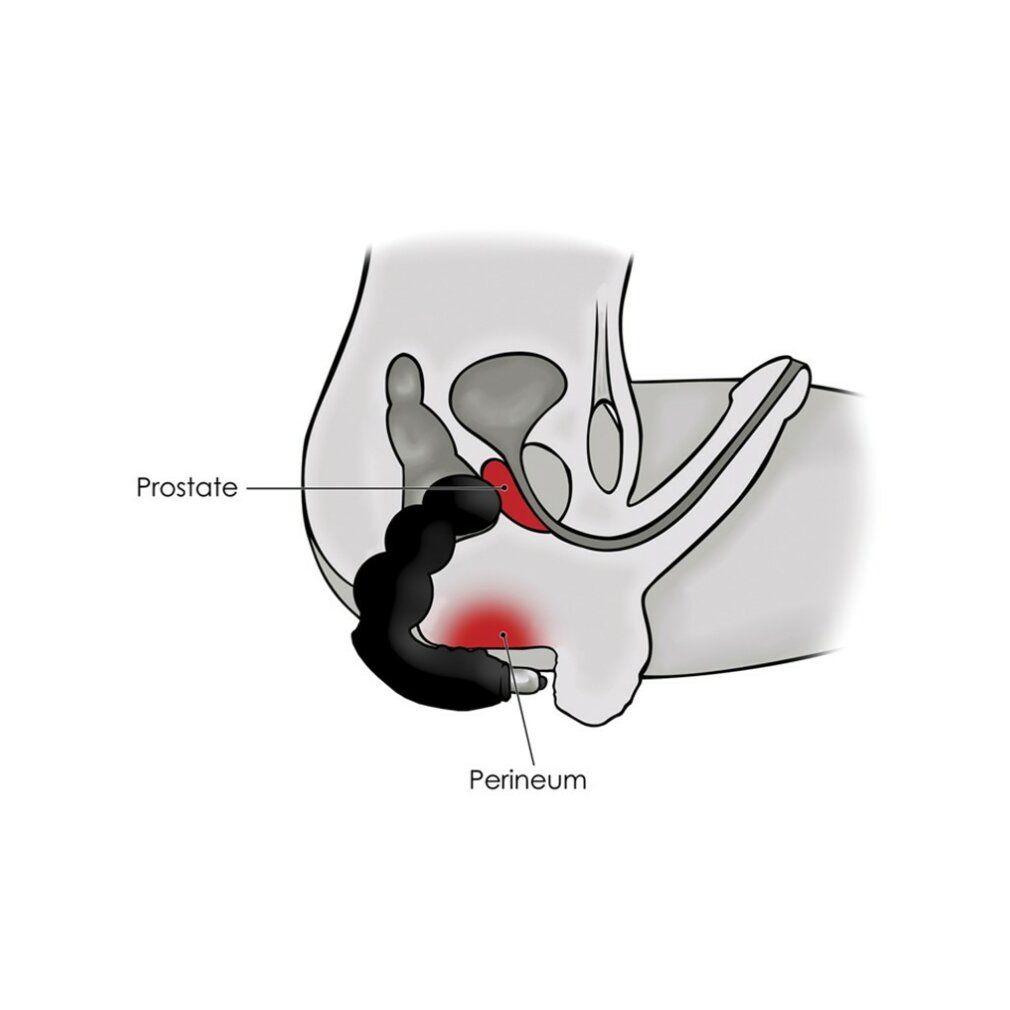 Illustrazione del bacino maschile. Il vibratore è posizionato vicino alla prostata. Etichette: Prostata, Perineo.