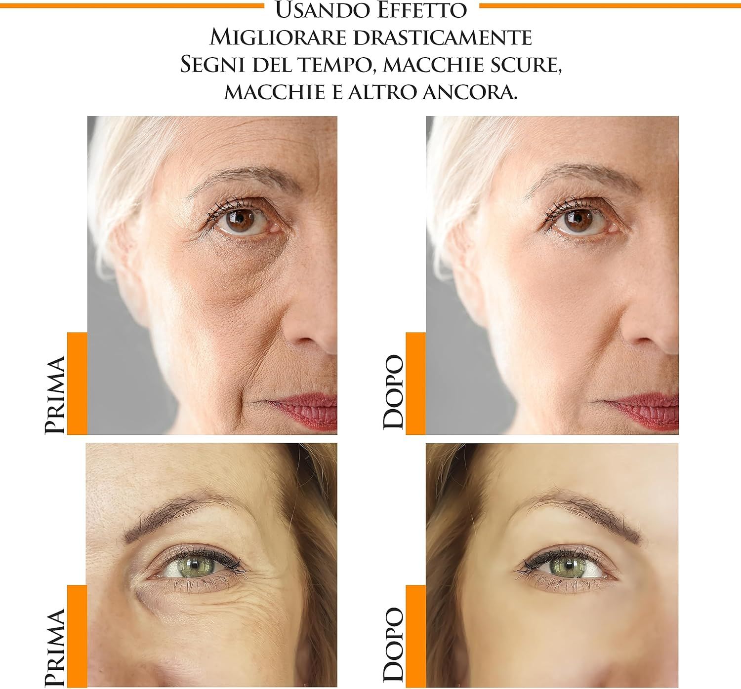 Confronto prima-dopo. Immagini delle zone degli occhi. Sinistra: prima. Destra: dopo. Riduzione di rughe e macchie.