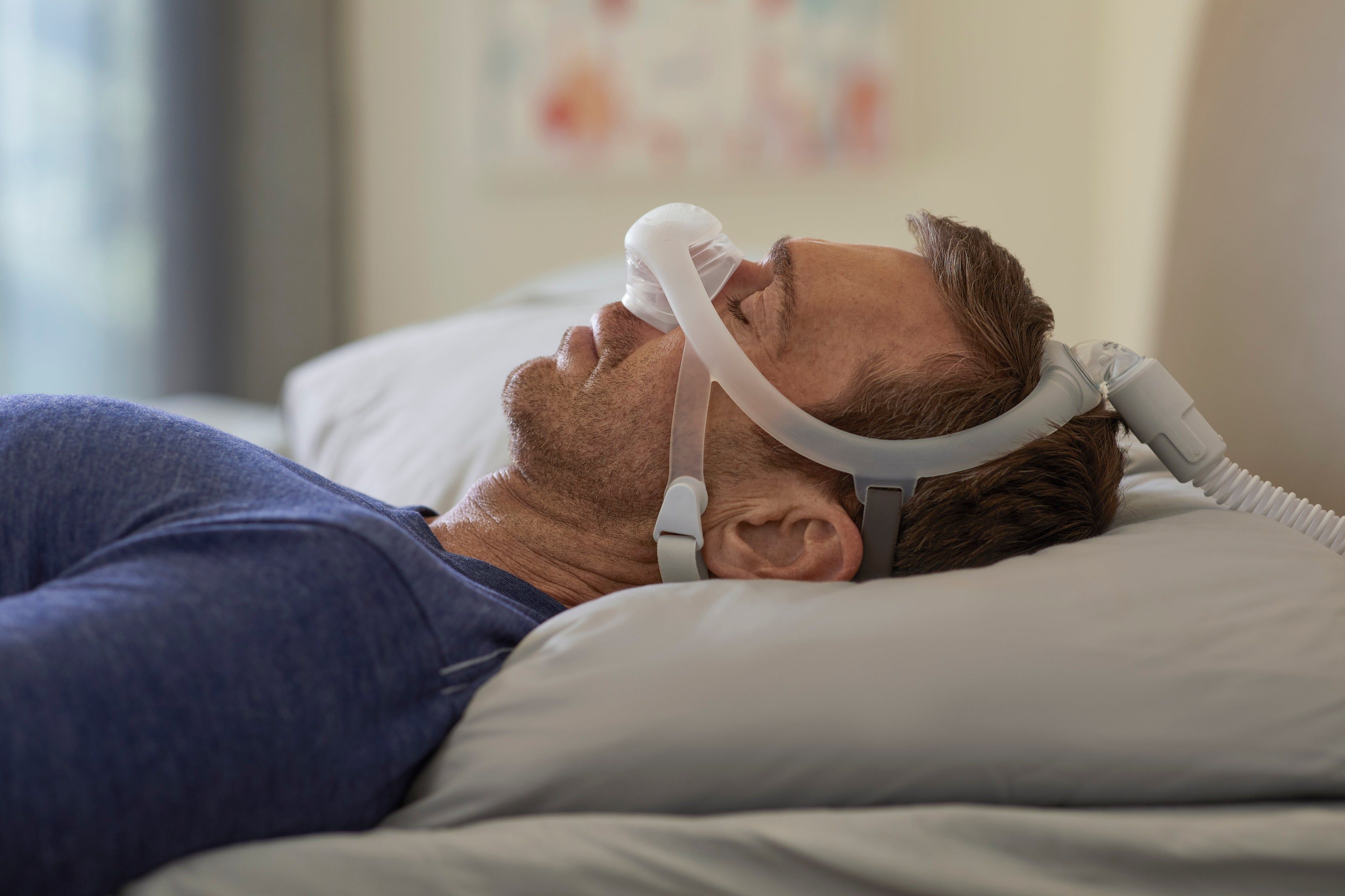 Uomo con maschera CPAP sul viso, sdraiato sulla schiena su un cuscino.
