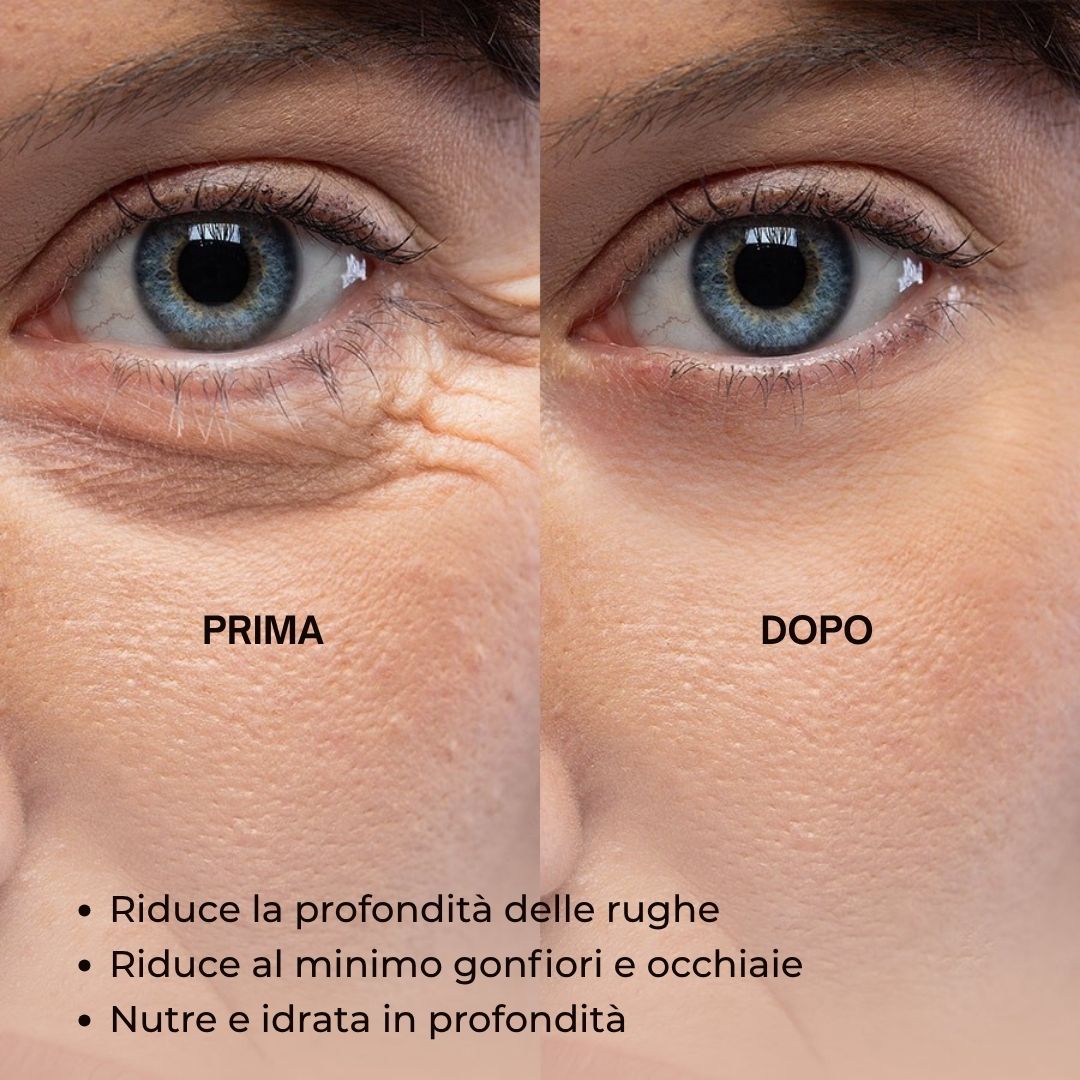 Immagine prima-dopo degli occhi. Rughe ridotte, occhiaie minimizzate. Testo: Anti-Aging Face Serum.