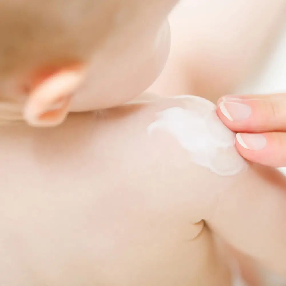 Primo piano di un bambino. Una mano applica crema sulla spalla del bambino.