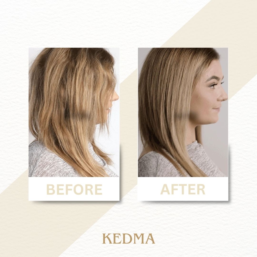 Kedma - Siero Capelli Riparatore alla Cheratina