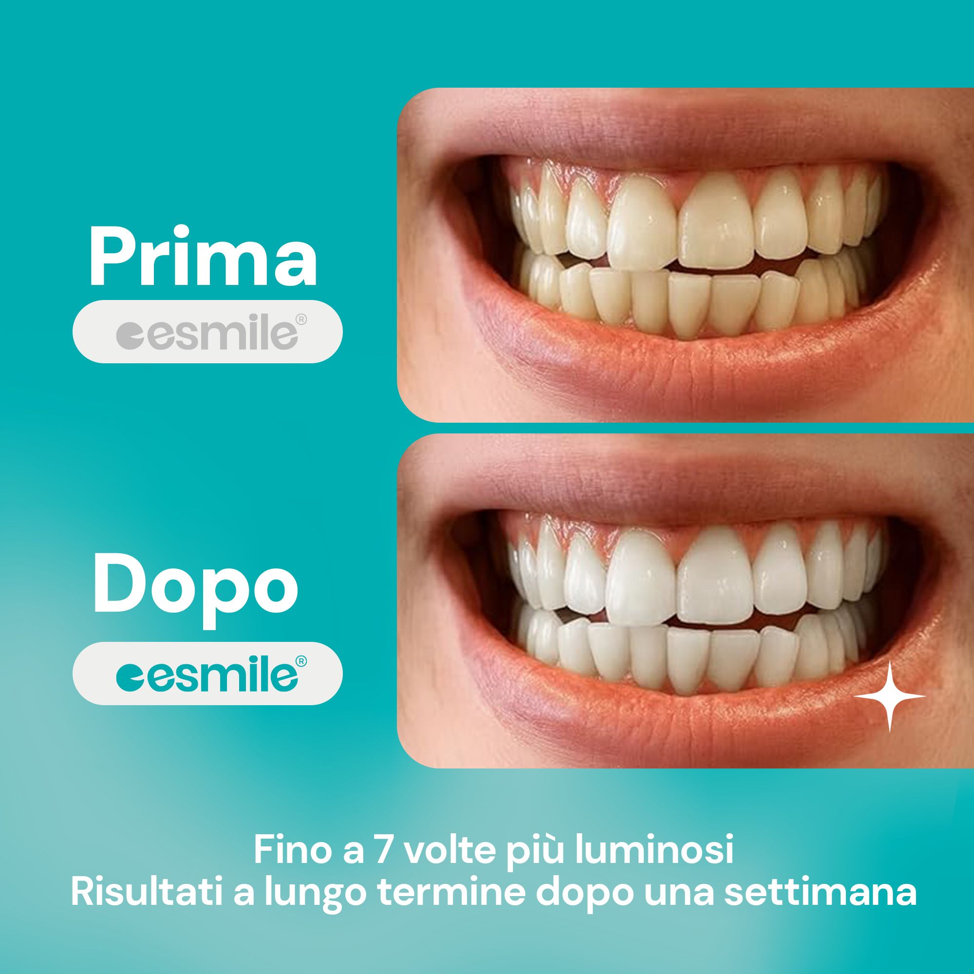 esmile - Strisce Sbiancanti Denti Menta