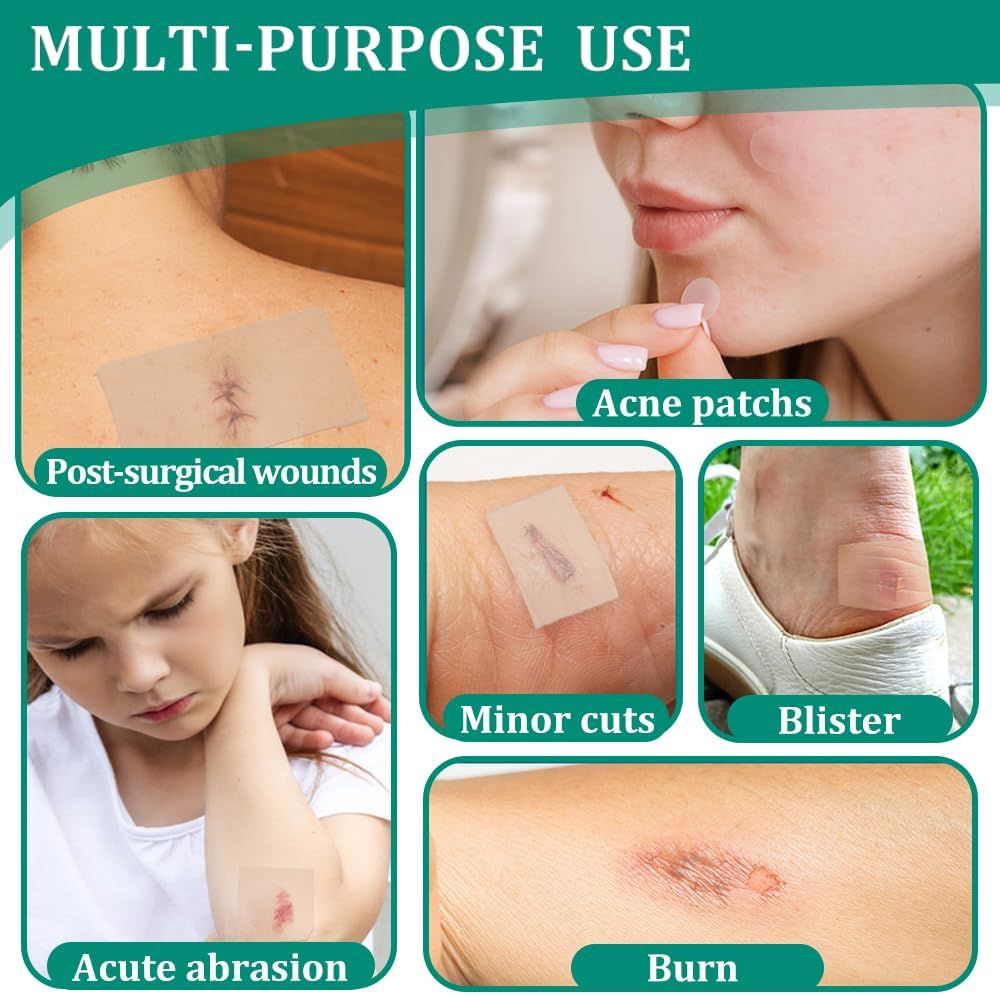 Esempi di utilizzo dei cerotti: post-operatorio, piccoli tagli, vesciche, abrasione acuta, ustione. Diverse zone della pelle.