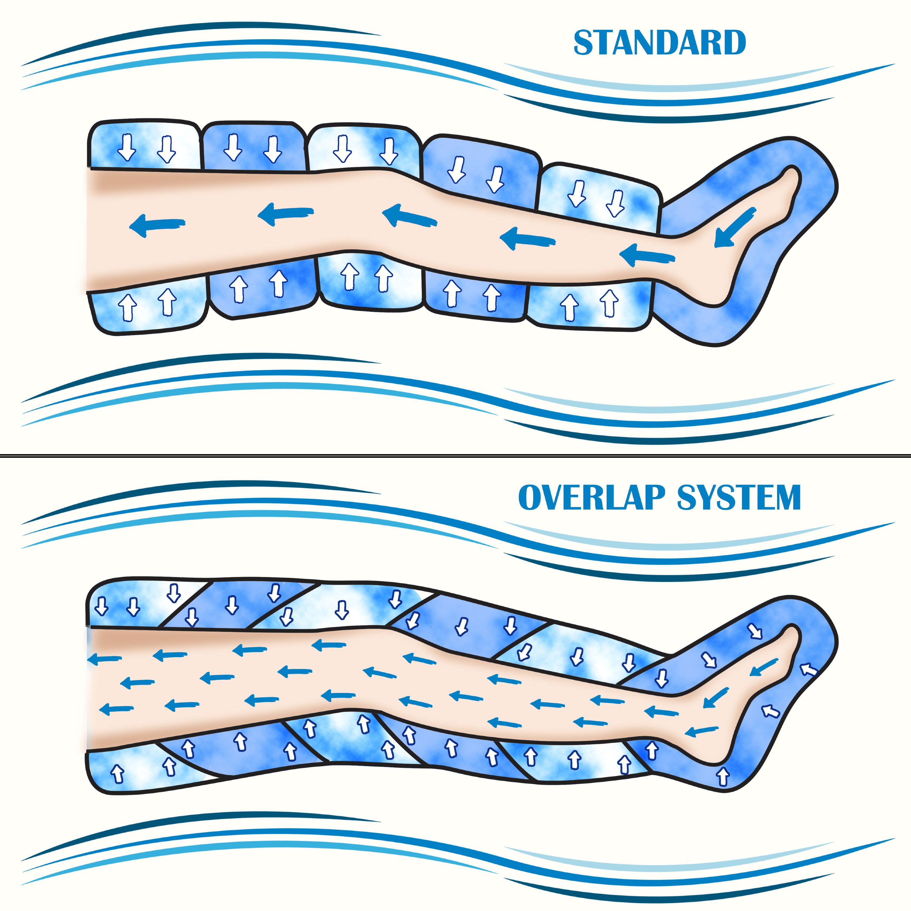 Illustrazione mostra due sistemi di compressione per le gambe: standard e a sovrapposizione. Le frecce indicano il flusso d'aria.