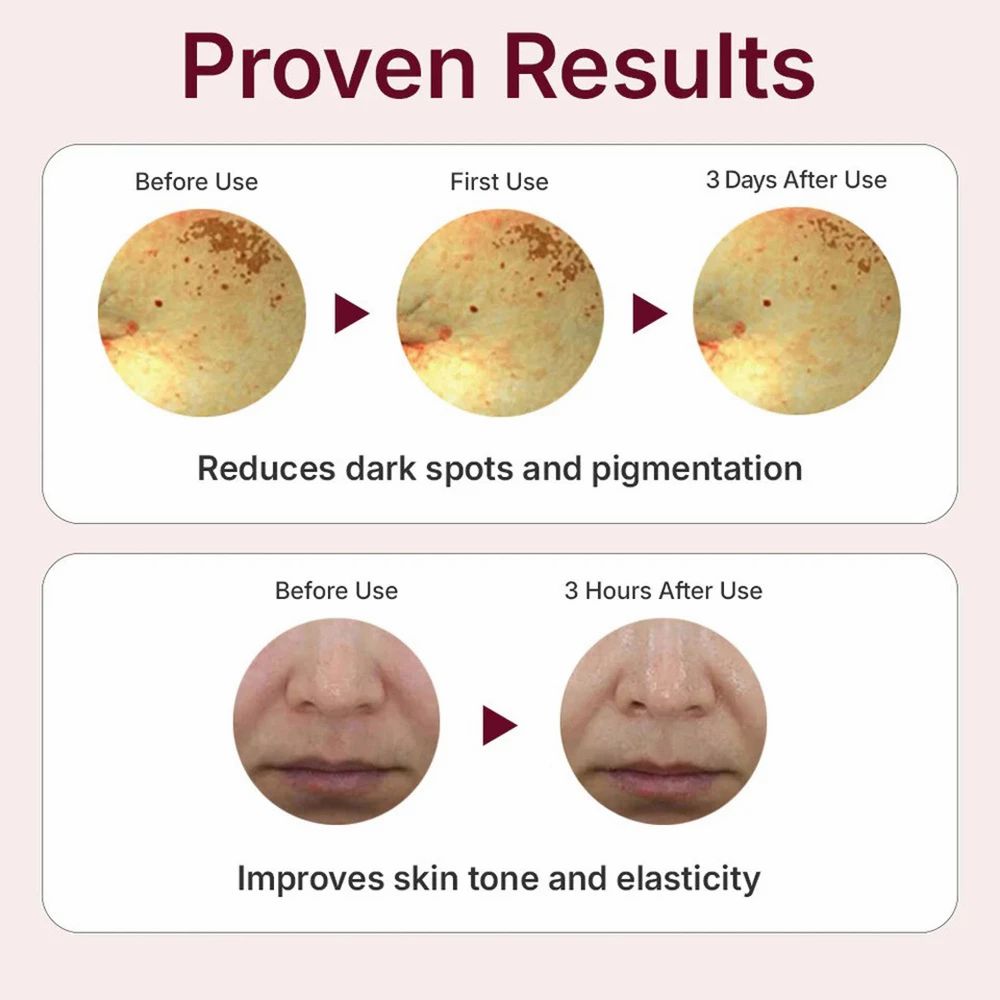 Confronto prima-dopo. Riduzione delle macchie scure e miglioramento dell'elasticità della pelle. Risultati dopo l'uso.